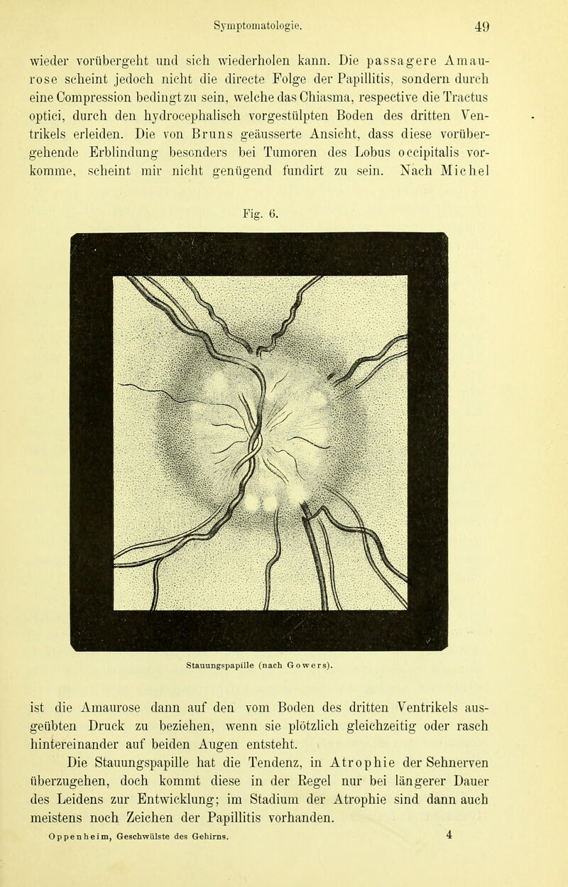 wieder vorübergeht und sich wiederholen kann. Die passagere Amau- rose seheint jedoch nicht die directe Folge der Papillitis, sondern durch eine Compression bedingt zu sein, welche das Ohiasma, respective dieTractus optici, durch den hydrocephalisch vorgestülpten Boden des dritten Ven- trikels erleiden. Die von Bruns geäusserte Ansicht, dass diese vorüber- gehende Erblindung besonders bei Tumoren des Lobus occipitalis vor- komme, scheint mir nicht genügend fundirt zu sein. Nach Michel Fig. 6. Stauungspapille (nach Gowers). ist die Amaurose dann auf den vom Boden des dritten Ventrikels aus- geübten Druck zu beziehen, wenn sie plötzlich gleichzeitig oder rasch hintereinander auf beiden Augen entsteht. Die Stauungspapille hat die Tendenz, in Atrophie der Sehnerven überzugehen, doch kommt diese in der Regel nur bei längerer Dauer des Leidens zur Entwicklung; im Stadium der Atrophie sind dann auch meistens noch Zeichen der Papillitis vorhanden. Oppenheim, Geschwülste des Gehirns. 4