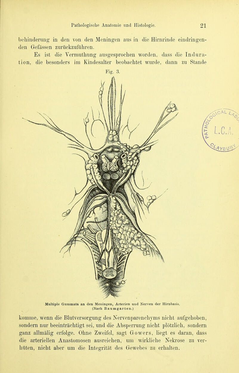 behinderung in den von den Meningen aus in die Hirnrinde eindringen- den Gefässen zurückzuführen. Es ist die Vermuthung ausgesprochen worden, dass die Indura- tion, die besonders im Kindesalter beobachtet wurde, dann zu Stande Fig. 3. Multiple Gummata an den Meningen, Arterien und Nerven der Hirnbasis. (Nach Baumgarten.) komme, wenn die Blutversorgung des Nervenparenehyms nicht aufgehoben, sondern nur beeinträchtigt sei, und die Absperrung nicht plötzlich, sondern ganz allmälig erfolge. Ohne Zweifel, sagt Gowers, liegt es daran, dass die arteriellen Anastomosen ausreichen, um wirkliche Nekrose zu ver- hüten, nicht aber um die Integrität des Gewebes zu erhalten.