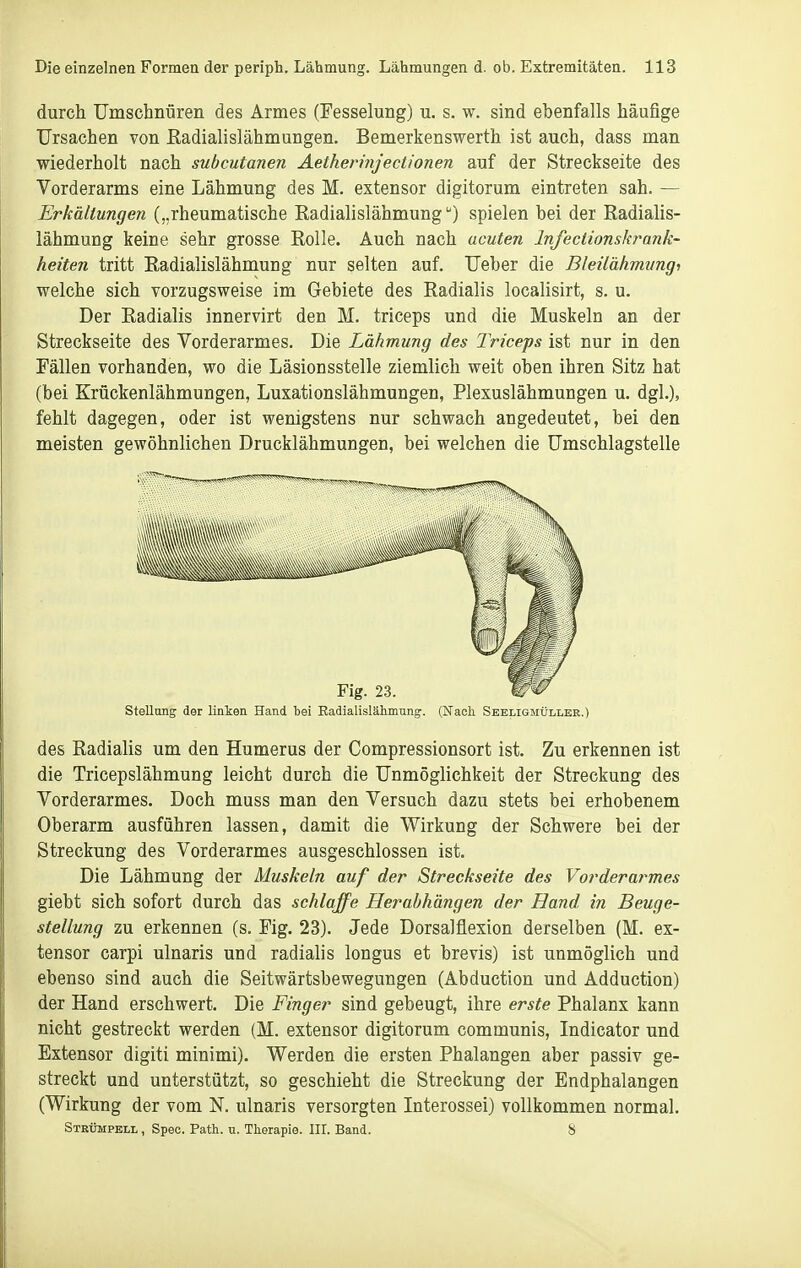durch TJmscbnüren des Armes (Fesselung) u. s. w. sind ebenfalls häufige Ursachen von ßadialislähmungen. Bemerkenswerth ist auch, dass man wiederholt nach subcutanen Aethennjectionen auf der Streckseite des Vorderarms eine Lähmung des M. extensor digitorum eintreten sah. — Erkältungen („rheumatische Radialislähmung) spielen bei der Radialis- lähmung keine sehr grosse Rolle. Auch nach acuten Infectionskrank- heiten tritt Radialislähmung nur selten auf. lieber die Bleüähmvngi welche sich vorzugsweise im Gebiete des Radialis localisirt, s. u. Der Radialis innervirt den M. triceps und die Muskeln an der Streckseite des Vorderarmes. Die Lähmung des Triceps ist nur in den Fällen vorhanden, wo die Läsionsstelle ziemlich weit oben ihren Sitz hat (bei Krückenlähmungen, Luxationslähmungen, Plexuslähmungen u. dgl.), fehlt dagegen, oder ist wenigstens nur schwach angedeutet, bei den meisten gewöhnlichen Drucklähmungen, bei welchen die Umschlagstelle Stellang der linken Hand tei Eadialislähmung. (Nach Seeligmüllee.) des Radialis um den Humerus der Compressionsort ist. Zu erkennen ist die Tricepslähmung leicht durch die Unmöglichkeit der Streckung des Vorderarmes. Doch muss man den Versuch dazu stets bei erhobenem Oberarm ausführen lassen, damit die Wirkung der Schwere bei der Streckung des Vorderarmes ausgeschlossen ist. Die Lähmung der Muskeln auf der Streckseite des Vorderarmes giebt sich sofort durch das schlaffe Herabhängen der Hand in Beuge- stellung zu erkennen (s. Fig. 23). Jede Dorsalflexion derselben (M. ex- tensor carpi ulnaris und radialis longus et brevis) ist unmöglich und ebenso sind auch die Seitwärtsbewegungen (Abduction und Adduction) der Hand erschwert. Die Finger sind gebeugt, ihre erste Phalanx kann nicht gestreckt werden (M. extensor digitorum communis, Indicator und Extensor digiti minimi). Werden die ersten Phalangen aber passiv ge- streckt und unterstützt, so geschieht die Streckung der Endphalangen (Wirkung der vom N. ulnaris versorgten Interossei) vollkommen normal. Strümpell , Spec. Path. u. Tliorapie. III. Band. 8