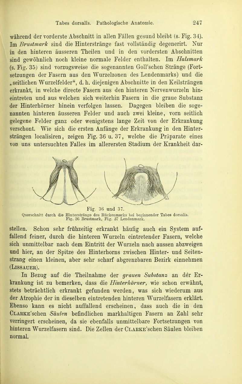 während der vorderste Abschnitt in allen Fällen gesund bleibt (s. Fig. 34). Im Brustmark sind die Hinterstränge fast vollständig degenerirt. Nur in den hinteren äusseren Theilen und in den vordersten Abschnitten sind gewöhnlich noch kleine normale Felder enthalten. Im Halsmark (s. Fig. 35) sind vorzugsweise die sogenannten Goll'schen Stränge (Fort- setzungen der Fasern aus den Wurzelzonen des Lendenmarks) und die „seitlichen Wurzelfelder, d, h, diejenigen Abschnitte in den Keilsträngen erkrankt, in welche directe Fasern aus den hinteren Nervenwurzeln hin- eintreten und aus welchen sich weiterhin Fasern in die graue Substanz der Hinterhörner hinein verfolgen lassen. Dagegen bleiben die soge- nannten hinteren äusseren Felder und auch zwei kleine, vorn seitlich gelegene Felder ganz oder wenigstens lange Zeit von der Erkrankung verschont. Wie sieh die ersten Anfänge der Erkrankung in den Hinter- strängen localisiren, zeigen Fig. 36 u. 37, welche die Präparate eines von uns untersuchten Falles im allerersten Stadium der Krankheit dar- Fig. 36 und 37. Querschnitt durch die Hinterstränge des Eückenmarks hei hegiunender Tahes dorsalis. Fig. 36 Brustmark, Fig. 37 Lendenmark. stellen. Schon sehr frühzeitig erkrankt häufig auch ein System auf- fallend feiner, durch die hinteren Wurzeln eintretender Fasern, welche sich unmittelbar nach dem Eintritt der Wurzeln nach aussen abzweigen und hier, an der Spitze des Hinterhorns zwischen Hinter- und Seiten- strang einen kleinen, aber sehr scharf abgrenzbaren Bezirk einnehmen (Lissauer). In Bezug auf die Theilnahme der grauen Substanz an der Er- krankung ist zu bemerken, dass die Hinterhörner, wie schon erwähnt, stets beträchtlich erkrankt gefunden werden, was sich wiederum aus der Atrophie der in dieselben eintretenden hinteren Wurzelfasern erklärt. Ebenso kann es nicht auffallend erscheinen, dass auch die in den CLARKE'schen Säulen befindlichen markhaltigen Fasern an Zahl sehr verringert erscheinen, da sie ebenfalls unmittelbare Fortsetzungen von hinteren Wurzelfasern sind. Die Zellen der CLARKE'schen Säulen bleiben normal.