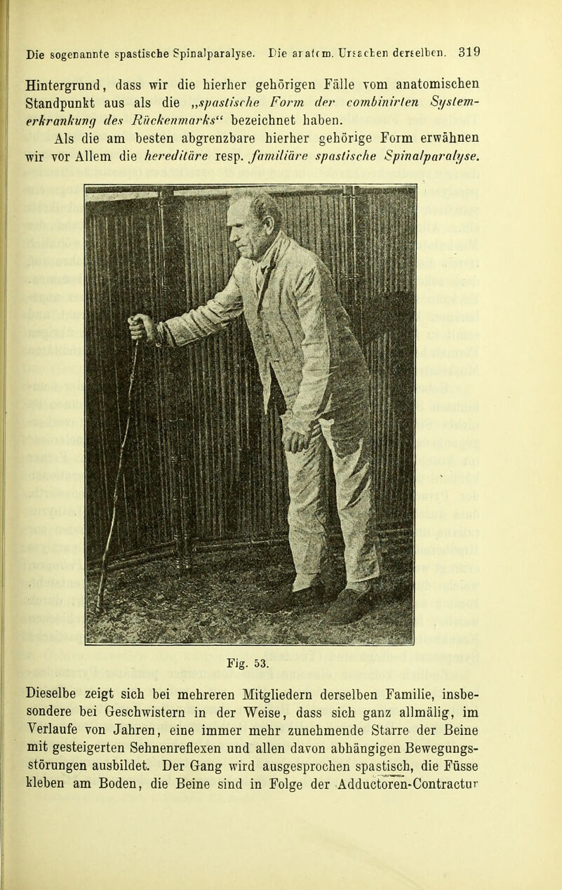 Hintergrund, dass wir die hierher gehörigen Fälle vom anatomischen Standpunkt aus als die „spastische Form det- combinirlen Si/slem- erkrankvnf) des Rückenmarks bezeichnet haben. Als die am besten abgrenzbare hierher gehörige Form erwähnen wir vor Allem die hereditäre resp. familiäre spastische Spinalparalyse. Fig. 53. Dieselbe zeigt sich bei mehreren Mitgliedern derselben Familie, insbe- sondere bei Geschwistern in der Weise, dass sich ganz allmälig, im Verlaufe von Jahren, eine immer mehr zunehmende Starre der Beine mit gesteigerten Sehnenreflexen und allen davon abhängigen Bewegungs- störungen ausbildet. Der Gang wird ausgesprochen spastisch, die Füsse kleben am Boden, die Beine sind in Folge der Adductoren-Contractur