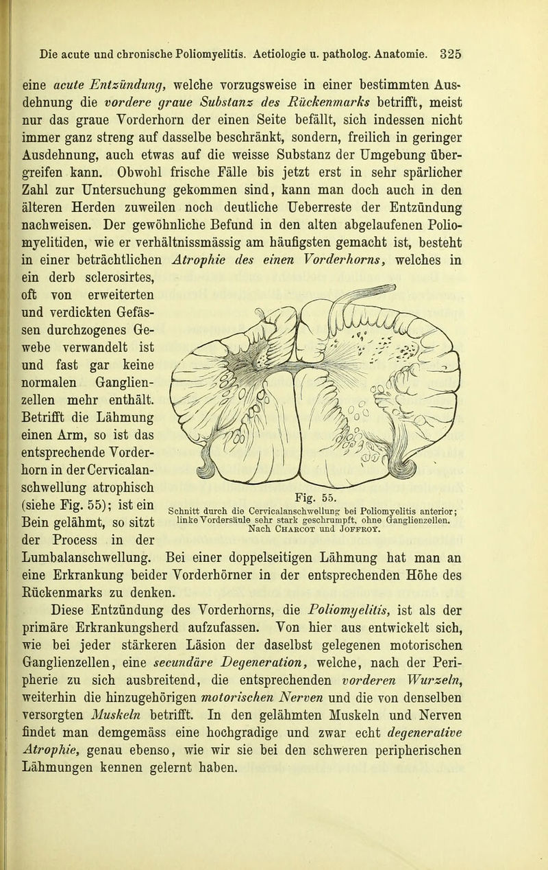 eine acute Entzündung, welche vorzugsweise in einer bestimmten Aus- dehnung die vordere graue Substanz des Rückenmarks betrifft, meist nur das graue Vorderhorn der einen Seite befällt, sich indessen nicht immer ganz streng auf dasselbe beschränkt, sondern, freilich in geringer Ausdehnung, auch etwas auf die weisse Substanz der Umgebung über- greifen kann. Obwohl frische Fälle bis jetzt erst in sehr spärlicher Zahl zur Untersuchung gekommen sind, kann man doch auch in den älteren Herden zuweilen noch deutliche Ueberreste der Entzündung nachweisen. Der gewöhnliche Befund in den alten abgelaufenen Polio- myelitiden, wie er verhältnissmässig am häufigsten gemacht ist, besteht in einer beträchtlichen Atrophie des einen Vorderhorns, welches in ein derb sclerosirtes. oft von erweiterten und verdickten Gefäs- sen durchzogenes Ge- webe verwandelt ist und fast gar keine normalen Ganglien- zellen mehr enthält. Betrifft die Lähmung einen Arm, so ist das entsprechende Vorder- horn in derCervicalan- schwellung atrophisch (siehe Fig. 55); ist ein Bein gelähmt, so sitzt der Process in der Lumbaianschwellung. Bei einer doppelseitigen Lähmung hat man an eine Erkrankung beider Vorderhörner in der entsprechenden Höhe des Rückenmarks zu denken. Diese Entzündung des Vorderhorns, die Poliomyelitis, ist als der primäre Erkrankungsherd aufzufassen. Von hier aus entwickelt sich, wie bei jeder stärkeren Läsion der daselbst gelegenen motorischen Ganglienzellen, eine secundäre Degeneration, welche, nach der Peri- pherie zu sich ausbreitend, die entsprechenden vorderen Wurzeln, weiterhin die hinzugehörigen motorischen Nerven und die von denselben versorgten Muskeln betrifft. In den gelähmten Muskeln und Nerven findet man demgemäss eine hochgradige und zwar echt degenerative Atrophie, genau ebenso, wie wir sie bei den schweren peripherischen Lähmungen kennen gelernt haben.