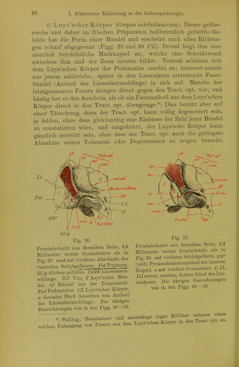 c) Luys'scher Körper (Corpus subtliälamicum). Dieses gefäss- reiclie und dalier an frischen Präparaten hellbräunlich gefärbte Ge- bilde hat die Form einer Mandel und erscheint nach allen Richtun- gen scharf abgegrenzt (Figg. 29 und 30 CL). Dorsal liegt ihm eine ziemlich beträchtliche Markkapsel an, welche eine Scheidewand zwischen ihm und- der Zona incerta bildet. Ventral schliesst sich dem Luys'schen Körper der Pedunculus cerebri an; letzterer nimmt aus jenem zahlreiche,- später in den Linsenkern eintretende Faser- bündel (Antheil der Linsenkernschlinge) in sich auf. Manche der letztgenannten Fasern dringen direct gegen den Tract. opt. vor, und häufig hat es den Anschein, als ob einFaserantheil aus dem Luys'schen Körper direct in den Tract. opt. übergienge.*) Dies beruht aber auf einer Täuschung, denn der Tract. opt. kann völlig degeneriert sein, ja fehlen, ohne dass gleichzeitig eine Einbusse der Zahl jener Bündel zu constatieren wäre, und umgekehrt, der Luys'sche Körper kann, gänzlich zerstört sein, ohne dass der Tract. opt. auch die geringste Abnahme seines Volumens oder Degeneration zu zeigen braucht. Put Ttnc P6d(frbr) Liscfii Fig. 31. Frontalschnitt aus derselben Serie, 4,^ Millimeter weiter frontalwärts als in Fig. 30. ant vorderer Sehliügelkern. -pyr (roth) Pyramidenbahnantheil der inneren Kapsel, c ant vordere Commissur. 7,11, III erstes, zweites, drittes Glied desLin- Fig. 30. Frontalschnitt aus derselben Serie, 4,6 Millimeter weiter frontalwärts als in Fig. 29. vent ant Vorderer Abschnitt des ventralen SelihügejLkems^wfPutamen. Gl p Globus pallidus. Lisch Linsenkern- schlinge. ßFVicqd'Azyr'sches Bün- ;:;-7;' üb.igen Bezeichmmgen del cf Bündel aus der Formxsaule. senkerns. vie uüiig« P^Pedunculus. CLLuys'scher Körper. wie m den F.gg. 2b-oO. X dorsales Mark desselben (ein Antheil der Linsenkernschlinge). Die übrigen Bezeichnungen wie in den Figg. 26 — 29.