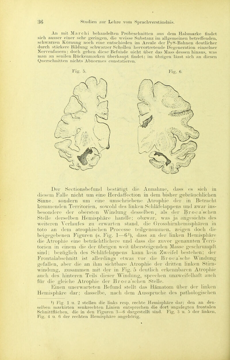An mit Marchi behandelten Probeschnitten aus dem Halsmarke findet sich ausser einer sehr geringen, die weisse Substanz im allgemeinen betreffenden, schwarzen Körnung noch eine entschieden im Areale der PyS-Bahnen deutlicher durch stärkere Bildung schwarzer Schollen hervortretende Degeneration einzelner Nervenfasern; doch gehen diese Befunde nicht über das Mass dessen hinaus, was man an senilen Eückenmarken überhaupt findet; im übrigen lässt sich an diesen Querschnitten nichts Abnormes constatieren. Der Sectionsbefund be.stätigt die Annahme, dass es sich in diesem Falle nicht um eine Herdatfection in dem bisher gebräuchlichen Sinne. sondern n.m eine umschidebene Atrophie der in Betracht kouniienden Territorien, sowohl des linhi^n Schläfelappens nnd zwar ins- besondere der obersten AVindung desselben, als der Broca'sihcn Stelle derselben Hemisphäre handle; obzwai', M'rs ja angesichts des weiteren Yerlaafes zu erwarten stand, (He nrossliiiiihcinispliärtni in toto an dem atropliischen Processe tcMlgciuniiiiicn. zeigen doch die beigegebenen Figuren (s. Fig. !■—6^), dass nn der linkt'U Hemisphäre die Atrophie eine beträchtlichere und dass (he zm'or genannten Terri- torien in einem die der übidgen weit übei'steigenden M;iss{' gesclu-unipft sind; bezüglich des Schläi'elappens l^ann kein ZA\eifel hestehen; der Frontalabschnitt ist allerdings etwas \'or die BrocM'si he AVinchmg gefallen, aber die an ihm siclitbai-e Atrophie der dritten linken Stirn- windung, zusammen mit der iir Fig. 5 deutlich (■rlcennbai'en Atropliie au(h d(.'S hinteren Teils dieser Windung, spi'eclien vmzweifelhaft auch für die gleiche Atrophie der Brocasehen Stelle. Einen unerwarteten Befund stellt das Hämatom über der linken Hemisphäre dar; dasselbe, nach dem Ausspruche des pathologisclien 1) Fig. 1 u. 2 stellen die links resp. rechte Hemisphäre dar; den an den- selben markirten senkrechten Linien entsprechen die dort angelegten frontalen Schnittflächen, die in den Figuren 3—6 dargestellt sind. Fig. :i u. b der linken. Fig. 4 u. 6 der rechten Hemisphäre angehörig.
