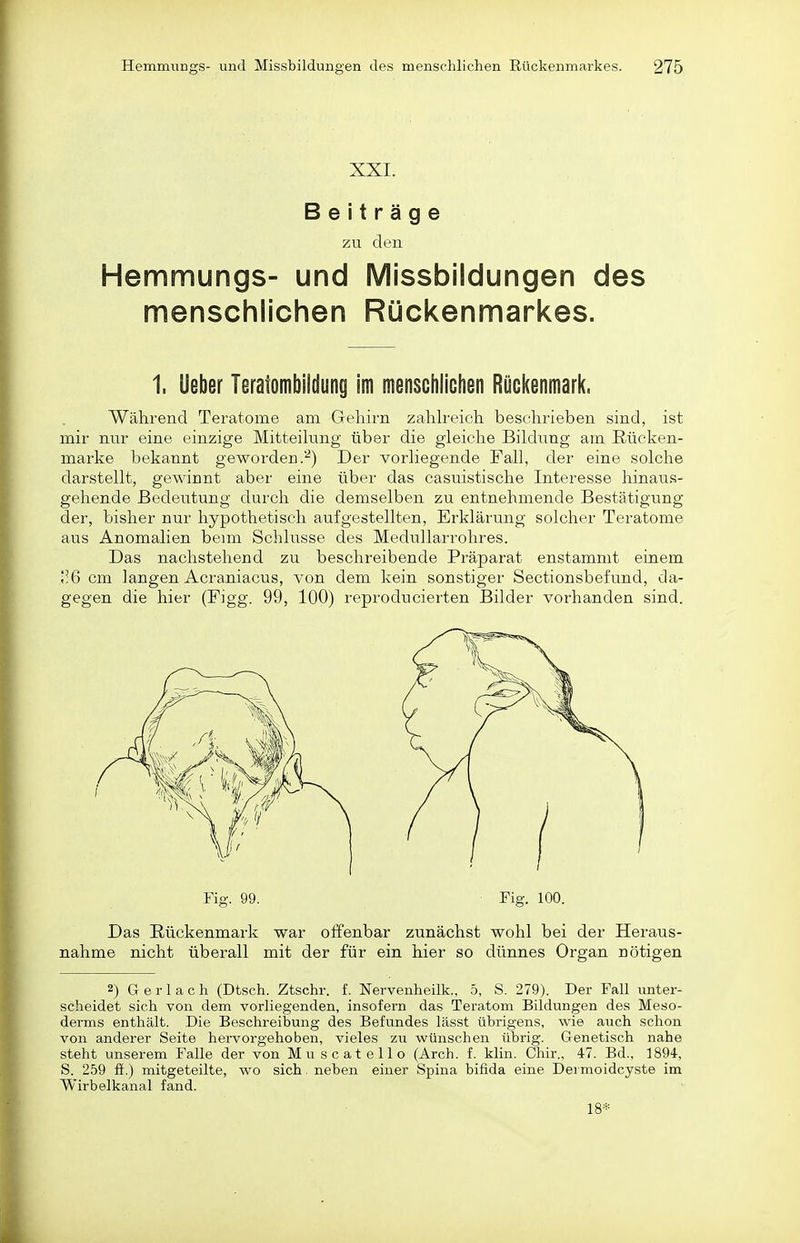 XXI. Beiträge zu den Hemmungs- und Missbildungen des menschlichen Rückenmarkes. 1. öeber Teratombiidung im menscfiiiclien Rückenmark, Während Teratome am Gehirn zahlreich beschrieben sind, ist mir nur eine einzige Mitteilung über die gleiche Bildung am ßücken- marke bekannt geworden.''^) Der vorliegende Fall, der eine solche darstellt, gewinnt aber eine über das casuistische Interesse hinaus- gehende Bedeutung durch die demselben zu entnehmende Bestätigung der, bisher nur hypothetisch aufgestellten, Erklärung solcher Teratome aus Anomalien bemi Schlüsse des Medullarrohres. Das nachstehend zu beschreibende Präparat enstammt einem l;6 cm langen Acraniacus, von dem kein sonstiger Sectionsbefund, da- gegen die hier (Figg. 99, 100) reproducierten Bilder vorhanden sind. Das Rückenmark war oifenbar zunächst wohl bei der Heraus- nahme nicht überall mit der für ein hier so dünnes Organ nötigen 2) Ger lach (Dtsch. Ztschr. f. Nervenheilk., 5, S. 279). Der Fall unter- scheidet sich von dem vorliegenden, insofern das Teratom Bildungen des Meso- derms enthält. Die Beschreibung des Befundes lässt übrigens, wie auch schon von anderer Seite hervorgehoben, vieles zu wünschen übrig. Genetisch nahe steht unserem Falle der von Muscatello (Arch. f. klin. Chir., 47. Bd., 1894-, S. 259 ff.) mitgeteilte, wo sich, neben einer Spina bifida eine Dermoidcyste im Wirbelkanal fand. 18*