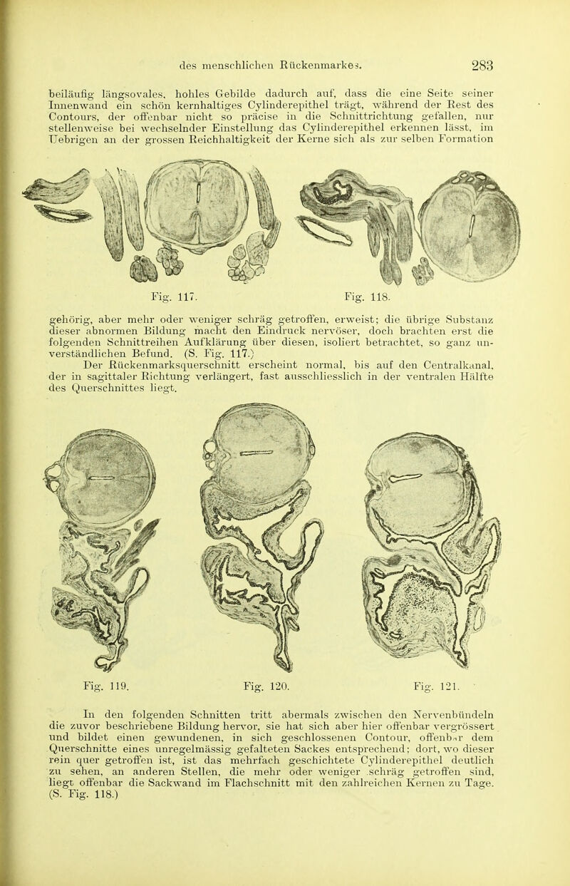 beiläufig' längsovales, hohles Grebilde dadurch auf, dass die eine Seite seiner Innenwand ein schön kernhaltiges Cylinderepithel trägt, während der Rest des Contours, der offenbar nicht so jjräcise in die Schnittrichtung gefallen, nur stellenweise bei wechselnder Einstellung das Cylinderepithel erkennen lässt, im TJebrigen an der grossen Reichhaltigkeit der Kerne sich als zur selben Formation Fig. 117. Fig. 118. gehörig, aber mehr oder weniger schräg getroffen, erweist; die übrige Substanz dieser abnormen Bildimg macht den Eindruck nervöser, doch brachten erst die folgenden Schnittreihen Aufklärung über diesen, isoliert betrachtet, so ganz un- verständlichen Befund. (S. Fig. 117.) Der Rückenmarksquerschnitt erscheint normal, bis auf den Centraikanal, der in sagittaler Richtung verlängert, fast ausschliesslich in der ventralen Hälfte des Querschnittes liegt. Fig. 119. Fig. 120. Fig. 121. In den folgenden Schnitten tritt abermals zwischen den Nervenbündeln die zuvor beschriebene Bildung hervor, sie hat sich aber hier offenbar vergrössert und bildet einen gewundenen, in sich geschlossenen Contour, offenbar dem Querschnitte eines unregelmässig gefalteten Sackes entsprechend: dort, wo dieser rein quer getroffen ist, ist das mehrfach geschichtete Cylinderepithel deutlich zu sehen, an anderen Stellen, die mehr oder weniger schräg getroffen sind, liegt offenbar die Sackwand im Flachschnitt mit den zahlreichen Kernen zu Tage. (S. Fig. 118.)