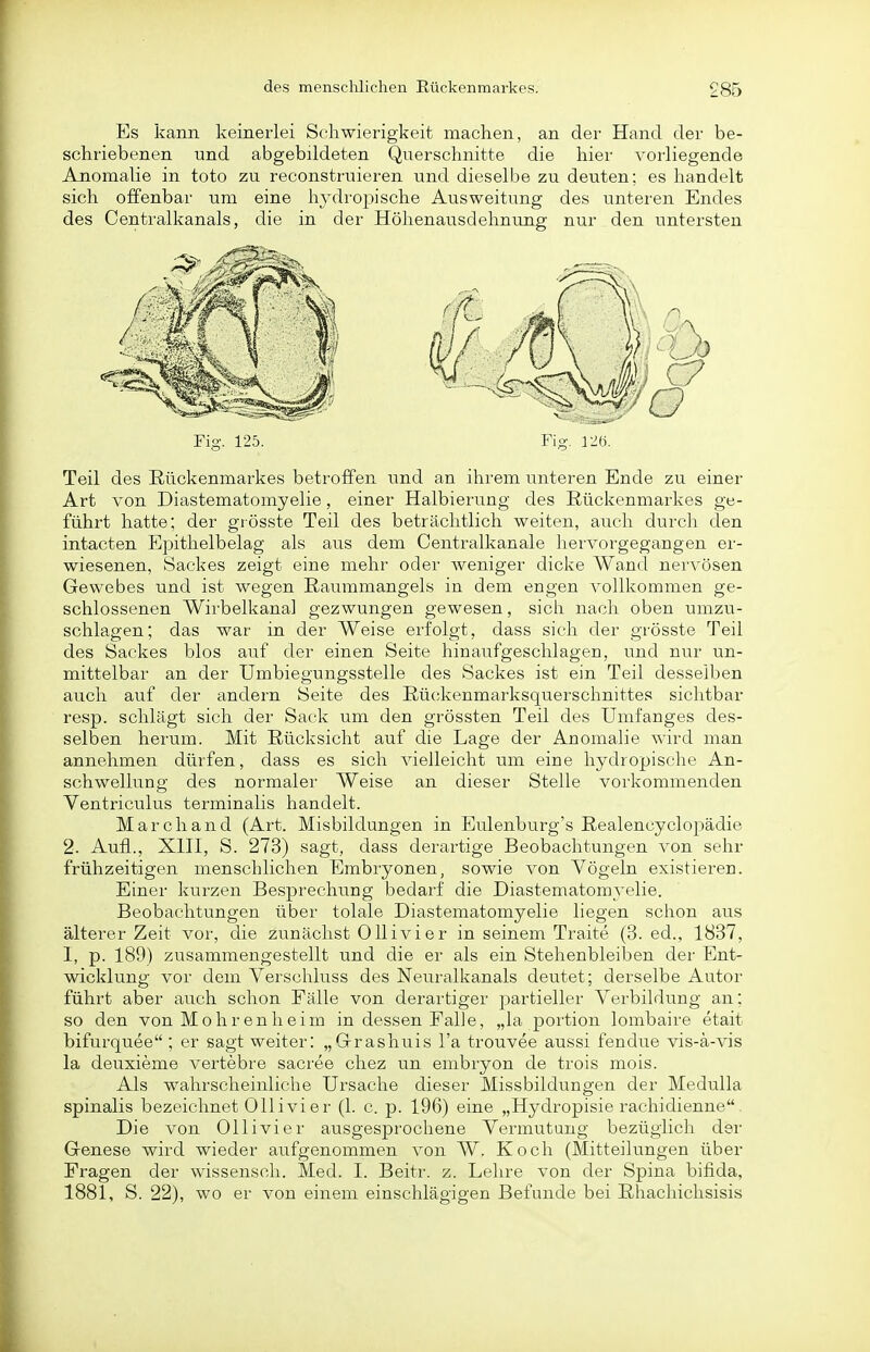 Es kann keinerlei Schwierigkeit machen, an der Hand der be- schriebenen und abgebildeten Querschnitte die hier Torliegende Anomalie in toto zu reconstruieren und dieselbe zu deuten; es handelt sich offenbar um eine hj'^dropische Ausweitung des unteren Endes des Centralkanals, die in der Höhenausdehnung nur den untersten Teil des Rückenmarkes betroifen und an ihrem unteren Ende zu einer Art von Diastematomyelie, einer Halbierung des Rückenmarkes ge- führt hatte; der grösste Teil des beträchtlich weiten, auch durch den intacten Epithelbelag als aus dem Centralkanale hervorgegangen er- wiesenen, Sackes zeigt eine mehr oder weniger dicke Wand nervösen Gewebes und ist wegen Raummangels in dem engen vollkommen ge- schlossenen Wirbelkanal gezwungen gewesen, sich nach oben umzu- schlagen; das war in der Weise erfolgt, dass sich der grösste Teil des Sackes blos auf der einen Seite hinaufgeschlagen, und nur un- mittelbar an der Umbiegungsstelle des Sackes ist ein Teil desselben auch auf der andern Seite des Rückenmarksquerschnittes sichtbar resp. schlägt sich der Sack um den grössten Teil des Umfanges des- selben herum. Mit Rücksicht auf die Lage der Anomalie wird man annehmen dürfen, dass es sich vielleicht um eine hydropische An- schwellung des normaler Weise an dieser Stelle vorkommenden Ventriculus terminalis handelt. Marchand (Art. Misbildungen in Eulenburg's Realencyclopädie 2. Aufl., Xni, S. 273) sagt, dass derartige Beobachtungen von sehr frühzeitigen menschlichen Embryonen, sowie von Vögeln existieren. Einer kurzen Besprechung bedarf die Diastematomyelie. Beobachtungen über tolale Diastematomyelie liegen schon aus älterer Zeit vor, die zunächst Olli vi er in seinem Traite (3. ed., 1837, I, p. 189) zusammengestellt und die er als ein Stehenbleiben der Ent- wicklung vor dem Verschluss des Neuralkanals deutet; derselbe Autor führt aber auch schon Fälle von derartiger partieller Verbildung an: so den von Mohren heim in dessen Falle, „la portion lombaire etait bifurquee ; er sagt weiter: „Grashuis l'a trouvee aussi fendue vis-ä-vis la deuxieme vertebre sacree chez un embryon de trois mois. Als wahrscheinliche Ursache dieser Missbildungen der Medulla spinalis bezeichnet Olli vi er (1. c. p. 196) eine „Hydropisie rachidienne Die von Ol Ii vi er ausgesprochene Vermutung bezüglich der Genese wird wieder aufgenommen von W. Koch (Mitteilungen über Fragen der wissensch. Med. I. Beitr. z. Lehre von der Spina bifida, 1881, S. 22), wo er von einem einschlägigen Befunde bei Rhachichsisis
