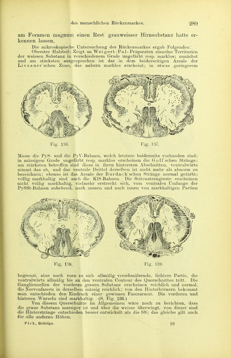 am Foramen magmim einen Rest grauweisser Hirnsubstanz hatte er- kennen lassen. Die mikroskopische Untersuchung des Rückenmarkes ergab Folgendes: Oberster Halsteil: Zeigt an Weigert-Pal-Präparaten einzelne Territorien der weissen Substanz in verschiedenem Grade ungefärbt resp. m^rklos; zunächst und am stärksten ausgesprochen ist das in dem beiderseitigen Ai'eale der Lis sau er'sehen Zone, das nahezu marklos erscheint; in etwas geringerem Fig. 136. Fig. 137. Masse die PyS- imd die PyV-Bahnen, welch letztere beiderseits vorhanden sind; in massigem Grade ungefärbt resp. marklos erscheinen die Göll'sehen Stränge; am stärksten betroffen sind diese in ihren hintersten Abschnitten, ventralwärts nimmt das ab, und das ventrale Drittel derselben ist nicht mehr als abnorm zu bezeichnen; ebenso ist das Areale der Burdach'sehen Stränge normal gefärbt; völlig markhaltig sind auch die KlS-Bahnen. Die Seitenstrangreste erscheinen nicht völlig markhaltig, vielmehr erstreckt sich, vom ventralen Umfange der PySSt-Bahnen anhebend, nach aussen und nach innen von markhaltigen Partien begrenzt, eine nach vorn zu sich allmälig verschmälernde, lichtere Pai-tie, die ventralwärts allmälig bis an den ventralen Contour des Querschnittes tritt. Die Ganglienzellen der vorderen grauen Substanz erscheinen reichlich rmd normal, die Nervenfasern in derselben mässig reichlich; von den Hinterhörnern bekommt man entschieden den Eindruck einer gewissen Faserarmut. Die vorderen und ■hinteren Wurzeln sind markhaltig. (S. Fig. 136.) Von diesem Querschnitte im Allgemeinen wäre noch zu berichten, dass die graue Substanz massiger ist imd über die weisse überwiegt, von dieser sind die ilinterstränge entschieden besser entwickelt als die SS; das gleiche gilt auch für alle anderen Höhen. Pick, Beiträge. 19