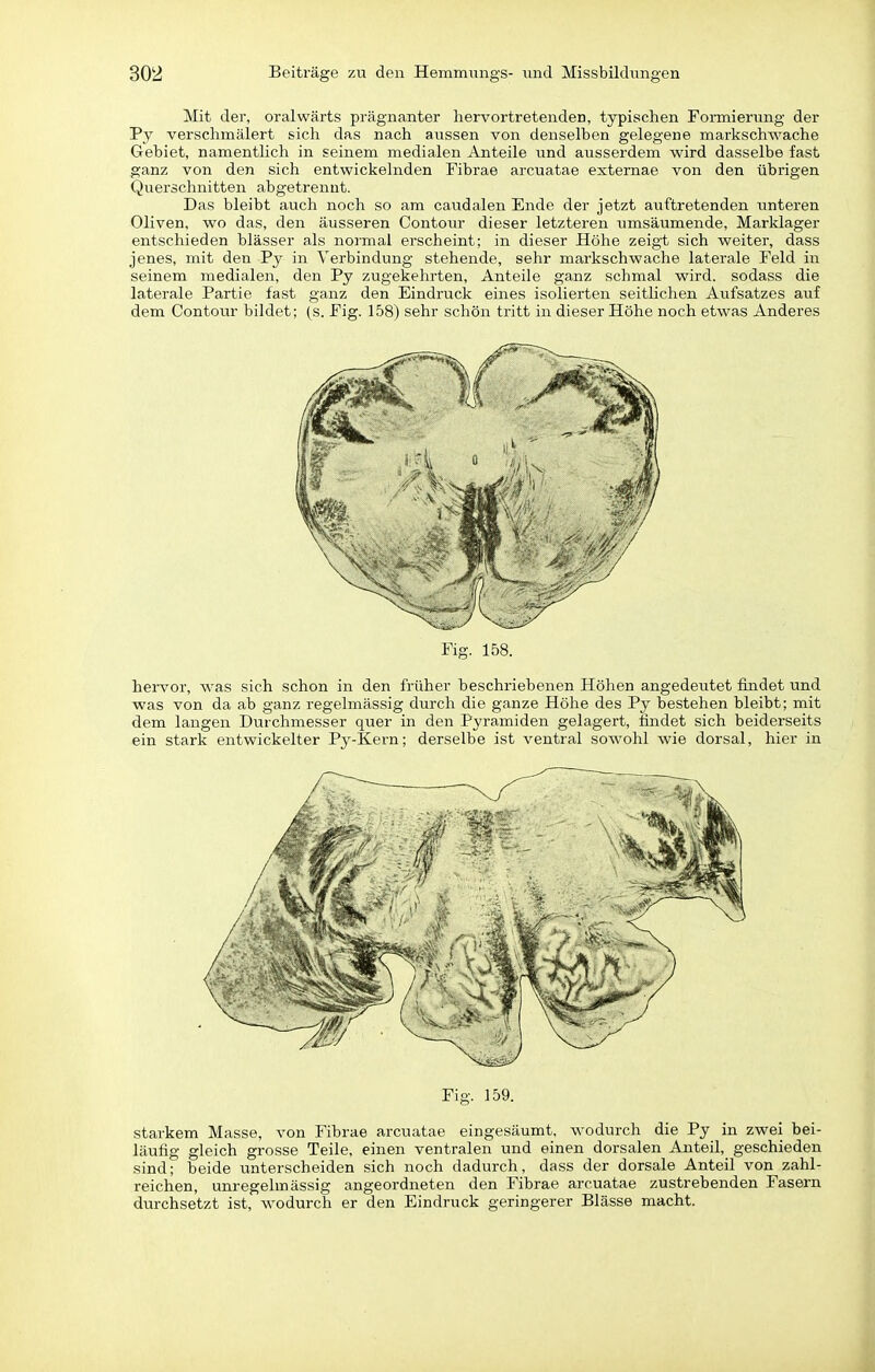 Mit der, oralwärts prägnanter hervortretenden, typischen Formierung der Py verschmälert sich das nach aussen von denselben gelegene markschwache Gebiet, namentlich in seinem medialen Anteile und ausserdem wird dasselbe fast ganz von den sich entwickelnden Fibrae arcuatae externae von den übrigen Querschnitten abgetrennt. Das bleibt auch noch so am caudalen Ende der jetzt auftretenden iinteren Oliven, wo das, den äusseren Contoiu- dieser letzteren umsäumende, Marklager entschieden blässer als normal erscheint; in dieser Höhe zeigt sich weiter, dass jenes, mit den Py in Verbindung stehende, sehr markschwache laterale Feld in seinem medialen, den Py zugekehrten, Anteile ganz schmal wird, sodass die laterale Partie fast ganz den Eindruck eines isolierten seitHchen Aufsatzes auf dem Contour bildet; (s. Fig. 158) sehr schön tritt in dieser Höhe noch etwas Anderes Fig. 158. hervor, was sich schon in den früher beschriebenen Höhen angedeutet findet und was von da ab ganz regelmässig durch die ganze Höhe des Py bestehen bleibt; mit dem langen Durchmesser quer in den Pyramiden gelagert, findet sich beiderseits ein stark entwickelter Py-Kern; derselbe ist ventral sowohl wie dorsal, hier in Fig. 159. starkem Masse, von Fibrae arcuatae eingesäumt, wodurch die Py in zwei bei- läufig gleich grosse Teile, einen ventralen und einen dorsalen Anteil, geschieden sind; beide unterscheiden sich noch dadurch, dass der dorsale Anteil von zahl- reichen, unregelmässig angeordneten den Fibrae arcuatae zustrebenden Fasern durchsetzt ist, wodurch er den Eindruck geringerer Blässe macht.