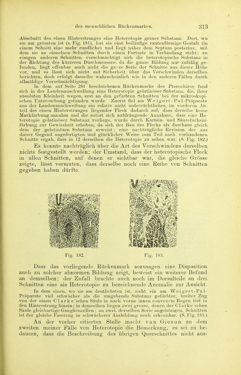Abschnitt des einen Hinterstranges eine Heterotopie grauer Substanz. Dort, wo sie am grössten ist (s. Fig. 181), hat sie eine beiläufige rautenförmige Gestalt (in einem Schnitt eine mehr rundliche) und liegt näher dem Septum posterius, mit dem sie an einzelnen Schnitten durch einen Fortsatz in Verbindung steht; an einigen anderen Schnitten verschmächtigt sich die heterotopische Substanz in der Richtung des kürzeren Durchmessers; da die ganze Bildung nur zufällig ge- funden, liegt offenbar auch nicht die ga-^ze Serie der Schnitte aus dieser Höhe vor, und es lässt sich nicht mit Sicherheit über das Verschwinden derselben berichten, doch erfolgt dasselbe wahrscheinlich wie in den anderen Fällen durch allmählige Verschmächtigung. In dem auf Seite 281 beschriebenen Eückenmarke des Pterochiros fand sich in der Lendenanschwellung eine Heterotopie gelatinöser Substanz, die, ihrer absoluten Kleinheit wegen, erst an den gefärbten Schnitten bei der mikroskopi- schen Untersuchung gefunden wurde. Zuerst fiel am We ig er t-Pal-Präparate aus der Lendenanschwellung ein relativ nicht unbeträchtlicher, im vorderen An- teil des einen Hinterstranges liegender Fleck dadurch auf, dass derselbe keine Markfärbung annahm und die sofort sich aufdrängende Annahme, dass eine He- terotopie gelatinöser Substanz vorliege, wurde durch Karmin- und Säurefuchsin- f'ärbung zur Gewissheit erhoben, da sich der B&xi des Flecks als durchaus gleich dem der gelatinösen Substanz erweist; eine nachträgliche Revision der aus dieser Gegend angefertigten und glücklicher Weise zum Teil noch vorhandenen Schnitte ergab, dass in 12 derselben die Heterotopie zu sehen war. (S. Fig. 182.) Es konnte nachträglich über die Art des Verschwindens derselben nichts festgestellt werden; der Umstand, dass der heterotopische Fleck in allen Schnitten, auf denen er sichtbar war, die gleiche G-rösse zeigte, lässt vermuten, dass derselbe noch eine Reihe von Schnitten gegeben haben dürfte. Fig. 182. Fig. 183. Dass das vorliegende Rückenmark sozusagen eine Disposition auch zii solcher abnormen Bildung zeigt, beweist ein weiterer Befund an demselben; der Zufall brachte auch noch im Dorsalteile an drei Schnitten eine als Heterotopie zu bezeichnende Anomalie zur Ansicht. In dem einen, wo sie am deutlichsten ist, zieht ein am Weigert-Pal- Präparate viel schwächer als die umgebende Substanz gefärbter, breiter Zug von der einen Clarke'sehen Säulein nach vorne innen convext^m Bogen tief in den Hinterstrang hinein; in demselben liegen zwei grosse, denen der Clarke'schen Säule gleichartige Ganglienzellen: an zwei, derselben Serie angehörigen. Schnitten ist der gleiche Faserzug in schwächerer Ausbildung noch erkennbar. (S. Fig. 183.) An der vorher citierten Stelle macht van Giesen zu dem zweiten meiner Fälle von Heterotopie die Bemerkung, es sei zu be- dauern, dass die Beschreibimg des übrigen Querschnittes nicht aus-