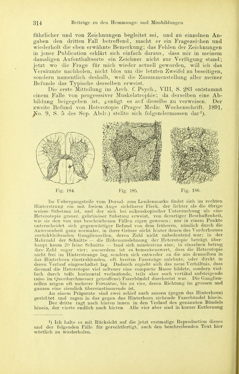 führlicher und von Zeichnungen begleitet sei, und zu einzelnen An- gaben den dritten Fall betreffend, macht er ein Fragezeichen und wiederholt die eben erwähnte Bemerkung; das Fehlen der Zeichnungen in jener Publication erklärt sich einfach daraus, dass mir in meinem damahgen Aufenthaltsorte ein Zeichner nicht zur Verfügung stand; jetzt wo die Frage für mich wieder actuell geworden, will ich das Versäumte nachholen, nicht blos um die letzten Zweifel zu beseitigen, sondern namentlich deshalb, weil die Zusammenstellung aller meiner Befunde das Typische derselben erweist. Die erste Mitteilung im Arch. f. Psych., VIII, S. 283 entstammt einem Falle von progressiver Muskelatrophie; da dei'selben eine Ab- bildung beigegeben ist, j^enügt es auf dieselbe zu verweisen. Der zweite Befund von Heterotopie (Prager Medic. Wochenschiift. 1891, ^0. 9, S. 5 des Sep. Abdr.) stellte sich folgendermassen dar^). Fig. 184. Fig. 18.5. Fig. 186. Im Uebergangsteile vom Dorsal- zum Leudenmarke findet sich im rechten Hinterstrang ein mit freiem Auge sichtbarer Fleck, der lichter als die übrige weisse Substanz ist, und der sicli bei mikroskopischer Untersuchung als eine Heterotopie grauer, gelatinöser Substanz erweist, von derartiger Beschaftenheit, wie sie den von uns beschriebenen Fällen eigen gewesen; nur in einem Punkte unterscheidet sich gegenwärtiger Befund von dem früheren, nämlich durch die Anwesenheit ganz normaler, in ihrer Grösse nicht hinter denen des Vorderhoi-nes zurückbleibenden Ganghenzellen, deren Zahl nicht unbedeutend war; in der Mehrzahl der Schnitte — die Höhenausdehnung der Heterotopie beträgt über- haupt kaum 20 feine Schnitte — fand sich mindestens eine, in einzelnen betrug ihre Zahl sogar vier; ausserdem ist es bemerkensAvert, dass die Heterotopie nicht frei im Hinterstrange lag, sondern sich entweder an die aus demselben in das Hinterhorn einstrahlenden, oft breiten Faserzüge anlehnte, oder direkt in deren Yerlaiif eingeschaltet lag. Dadiu-ch ergiebt sich das newe Verhältnis, dass diesmal die Heterotopie viel seltener eine compacte Masse bildete, sondern viel- fach durch teils horizontal verlaufende, teils aber auch vertikal aufsteigende (also im Querdurchmesser getroffene) Faserbündel durchsetzt war. Die Ganglien- zellen zeigen oft mehrere Fortsätze, bis zu vier, deren ßichtung im grossen und ganzen eine ziemlich übereinstimmende ist. An einem Präparate sind zwei schief nach aussen (gegen das Hinterhorn) gerichtet und ragen in das gegen das Hinterhorn ziehende Faserbündel hinpin. Der dj-itte ragt nach hinten innen in den Verlauf des genannten Bündels hinein, der vierte endlich nach hinten. Alle vier aber sind in kurzer Entfernung 1) Ich halte es mit Eücksicht auf die jetzt erstmalige Eeproduction dieses und der folgenden Fälle für gerechtfertigt, auch den beschreibenden Text hier wörtlich zu wiederholen.