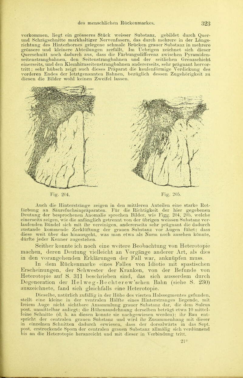 vorkommen, liegt ein grösseres Stück weisser Substanz, gebildet durch Quer- und Schrägschnitte markhaltiger Nervenfasern, das durch mehrere in der Längs- richtung des Hinterhornes gelegene schmale Brücken grauer Siibstanz in mehrere grössere und kleinere Abteilungen zerfällt. Im Uebrigen zeichnet sich dieser Querschnitt noch dadurch aus, dass die Färbungsdifferenz zwischen Pyramiden- seitenstrangbahnen, den Seitenstrangbahnen und der seitlichen Grenzschicht einerseits, und den Klemhirnseitenstrangbahnen andererseits, sehr prägnant hervor- tritt ; sehr hübsch zeigt auch dieses Präparat die keulenförmige Verdickung des vorderen Endes der letztgenannten Bahnen, bezüglich dessen Zugehörigkeit zu diesen die Bilder wohl keinen Zweifel lassen. Fig. 204. Fig. 205. Axich die Hinterstränge zeigen in den mittleren Anteilen eine starke Eot- färbung an Säurefuchsinpräparaten. Für die Richtigkeit der hier gegebenen Deutung der besprochenen Anomalie sprechen Bilder, wie Figg. 20-1-, 205, welche einerseits zeigen, wie die anfänglich getrennt von der übrigen weissen Substanz ver- laufenden Bündel sich mit ihr vereinigen, andererseits sehr prägnant die dadurch zustande kommende Zerklüftung der grauen Substanz vor Augen führt; dass diese weit über das hinausgeht, was man etwa als Norm noch ansehen könnte, dürfte jeder Kenner zugestehen. Seither konnte ich noch eine weitere Beobachtung von Heterotopie machen, deren Deutung vielleicht an Vorgänge anderer Art, als dies in den vorangehenden Erklärungen der Fall war, anknüpfen muss. In dem Rückenmarke eines Falles von Idiotie mit spastischen Erscheinungen, der Schwester der Kranken, von der Befunde von Heterotoj^ie auf S. 811 beschrieben sind, das sich ausserdem durch Degeneration der He 1 we g-B e cht er ew'sehen Bahn (siehe S. 230) auszeichnete, fand sich gleichfalls eine HeterotojDie. Dieselbe, natürlich zufällig in der Höhe des vierten Halssegmentes gefunden, stellt eine kleine in der ventralen Hälfte eines Hinterstranges liegende, mit freiem Auge nicht sichtbare Ansammlung grauer Substanz dar, die dem fSulcus post. unmittelbar anliegt: die Höhenausdehnung derselben beträgt etwa 10 mittel- feine Schnitte (d. h. an diesen konnte sie nachgewiesen werden); ihr Bau ent- spricht der centralen grauen Substanz und wird ihr Zusammenhang mit dieser in einzelnen Schnitten dadurch erwiesen, dass der dorsalwärts in das Sept. post. erstreckende Sporn der centralen grauen Substanz allmälig sich verdünnend bis an die Heterotopie heranreicht und mit dieser in Verbindung tritt. 21'-=