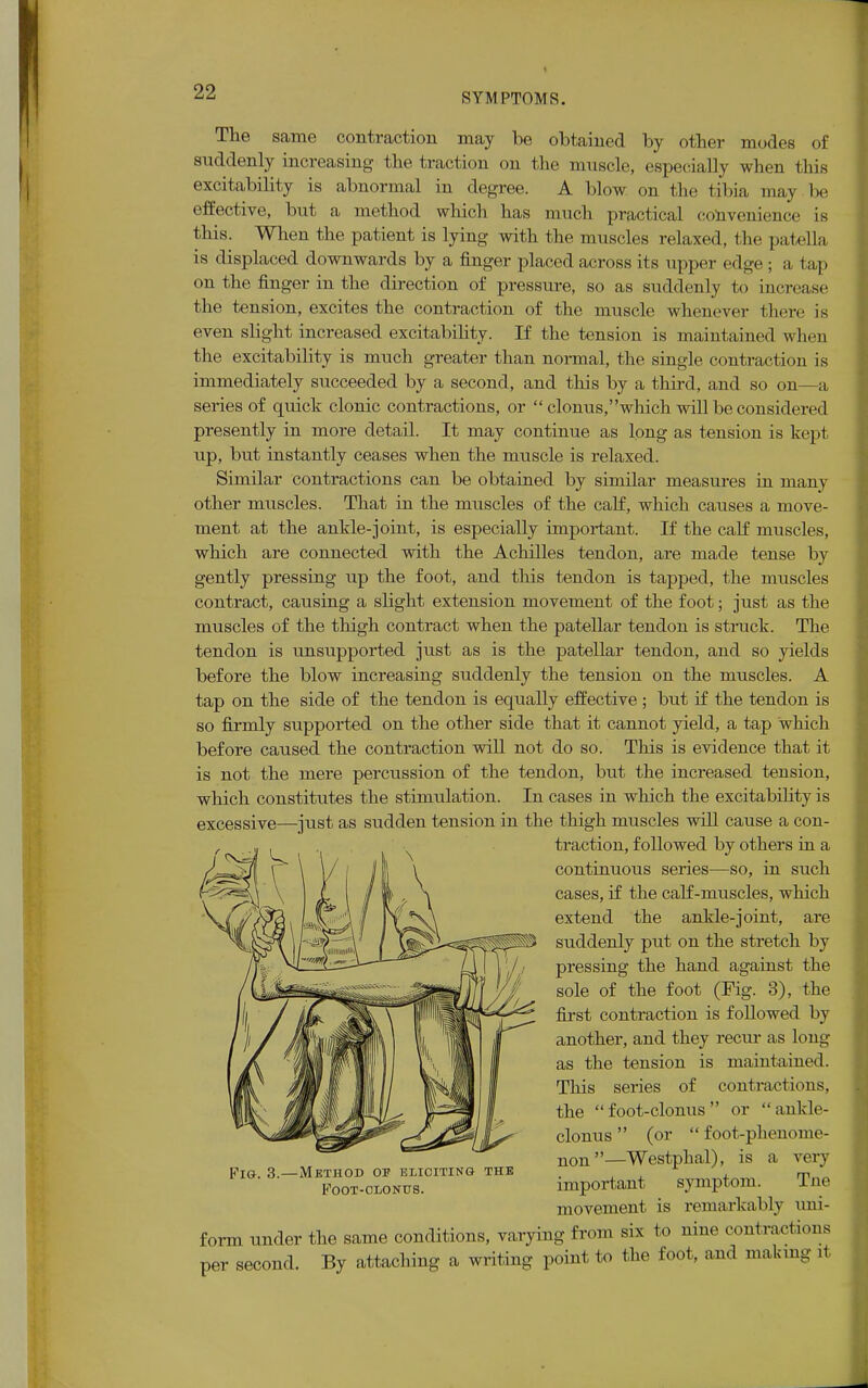 SYMPTOMS. The same contraction may be obtained by other modes of suddenly increasing the traction on the muscle, especially when this excitability is abnormal in degree. A blow on the tibia may be effective, but a method which has much practical convenience is this. When the patient is lying with the muscles relaxed, the patella is displaced downwards by a finger placed across its upper edge; a tap on the finger in the direction of pressure, so as suddenly to increase the tension, excites the contraction of the muscle whenever there is even slight increased excitability. If the tension is maintained when the excitability is much greater than normal, the single contraction is immediately succeeded by a second, and this by a third, and so on—a series of quick clonic contractions, or  clonus,which will be considered presently in more detail. It may continue as long as tension is kept up, but instantly ceases when the muscle is relaxed. Similar contractions can be obtained by similar measures in many other muscles. That in the muscles of the calf, which causes a move- ment at the ankle-joint, is especially important. If the calf muscles, which are connected with the Achilles tendon, are made tense by gently pressing up the foot, and this tendon is tapped, the muscles contract, causing a slight extension movement of the foot; just as the muscles of the thigh contract when the patellar tendon is struck. The tendon is unsupported just as is the patellar tendon, and so yields before the blow increasing suddenly the tension on the muscles. A tap on the side of the tendon is equally effective ; but if the tendon is so firmly supported on the other side that it cannot yield, a tap which before caused the contraction will not do so. This is evidence that it is not the mere percussion of the tendon, but the increased tension, which constitutes the stimulation. In cases in which the excitability is excessive—just as sudden tension in the thigh muscles will cause a con- traction, followed by others in a continuous series—so, in such cases, if the calf-muscles, which extend the ankle-joint, are suddenly put on the stretch by pressing the hand against the sole of the foot (Fig. 3), the first contraction is followed by another, and they recur as long as the tension is maintained. This series of contractions, the foot-clonus or -ankle- clonus  (or  foot-phenome- non—Westphal), is a very important symptom. Tne movement is remarkably uni- form under the same conditions, varying from six to nine contractions per second. By attaching a writing point to the foot, and making >1 Fig. 3.- -method or eliciting the Foot-clonus.