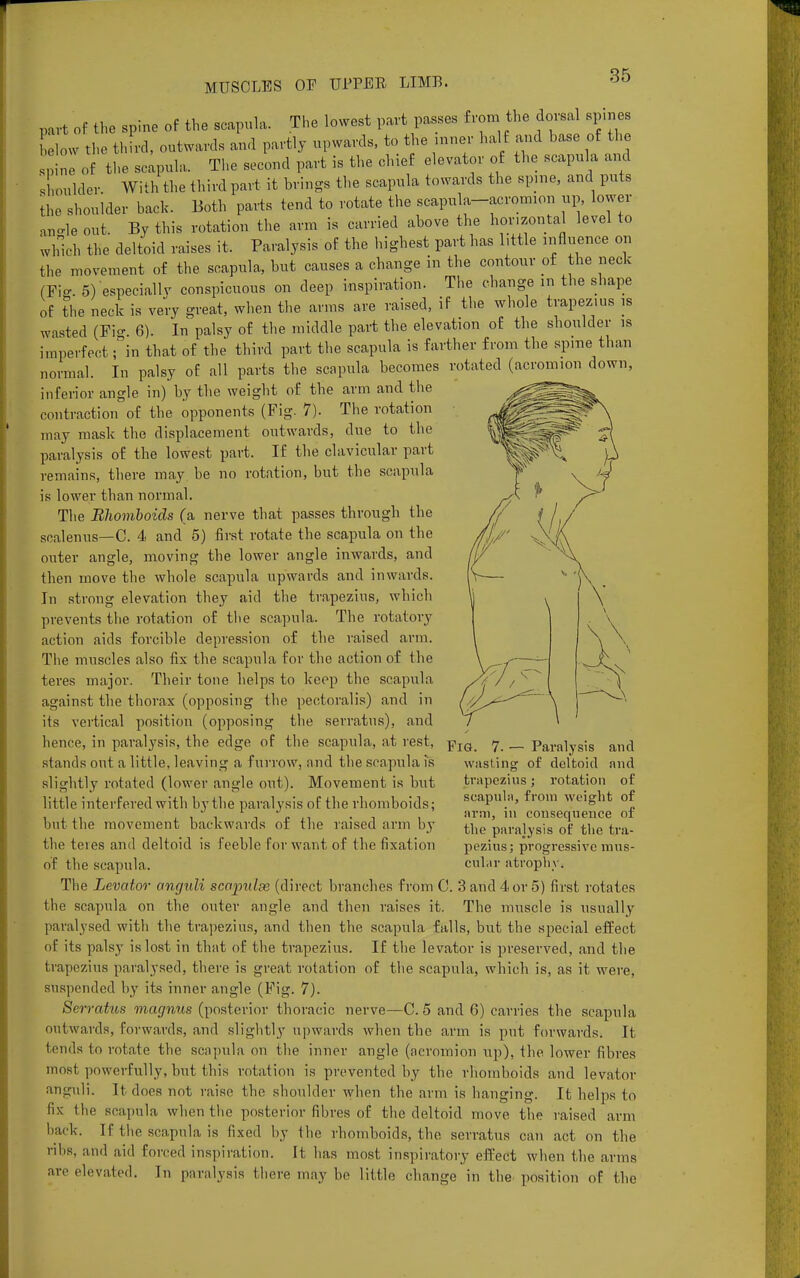 part of the spine of the scapula. The lowest part passes from the doisal b, > e Low the third, outwards and partly upwards, to the inner half and base of the S72 of the scapula. The second part is the chief elevator of the scapula and shoulder With the third part it brings the scapula towards the spine, and puts the shoulder back. Both parts tend to rotate the scapula-acromion up, lower an-le out. By this rotation the arm is carried above the horizontal level to which the deltoid raises it, Paralysis of the highest part has little influence on the movement of the scapula, but causes a change in the contour of the neck (Fio-. 5) especially conspicuous on deep inspiration. The change in the shape of the neck is very great, when the arms are raised, if the whole trapezius is wasted (Fio- 6). In palsy of the middle part the elevation of the shoulder is imperfect Tin that of the third part the scapula is farther from the spine than normal. In palsy of all parts the scapula becomes rotated (acromion down, inferior angle in) by the weight of the arm and the contraction of the opponents (Fig. 7). The rotation may mask the displacement outwards, due to the paralysis of the lowest part. If the clavicular part remains, there may be no rotation, but the scapula is lower than normal. The Rhomboids (a nerve that passes through the scalenus—C. 4 and 5) first rotate the scapula on the outer angle, moving the lower angle inwards, and then move the whole scapula upwards and inwards. In strong elevation they aid the trapezius, which prevents the rotation of the scapula. The rotatory action aids forcible depression of the raised arm. The muscles also fix the scapula for the action of the teres major. Their tone helps to keep the scapula against the thorax (opposing the pert oralis) and in its vertical position (opposing the serratus), and hence, in paralysis, the edge of the scapula, at rest, j?JQ 7 Paralysis and stands out a little, leaving a furrow, and the scapula is wasting of deltoid and slightly rotated (lower angle out). Movement is but little interfered with by the paralysis of the rhomboids; but the movement backwards of the raised arm by the teres and deltoid is feeble for want of the fixation of the scapula. The Levator angidi scapulae (direct branches from C. 3 and 4 or 5) first rotates the scapula on the outer angle and then raises it. The muscle is usually paralysed with the trapezius, and then the scapula falls, but the special effect of its palsy is lost in that of the trapezius. If the levator is preserved, and the trapezius paralysed, there is great rotation of the scapula, which is, as it were, suspended by its inner angle (Fig. 7). Serratus magnus (posterior thoracic nerve—C. 5 and 6) carries the scapula outwards, forwards, and slightly upwards when the arm is put forwards. It tends to rotate the scapula on the inner angle (acromion up), the lower fibres most powerfully, but this rotation is prevented by the rhomhoids and levator anguli. It. does not raise the shoulder when the arm is hanging. It helps to fix the scapula when the posterior fibres of the deltoid move the raised arm hack. If the scapula is fixed by the rhomboids, the serratus can act on the ribs, and aid forced inspiration. It has most inspiratory effect when the arms are elevated. In paralysis there may be little change in the position of the trapezius; rotation of scapula, from weight of arm, in consequence of the paralysis of the tra- pezius; progressive mus- cular atrophy.