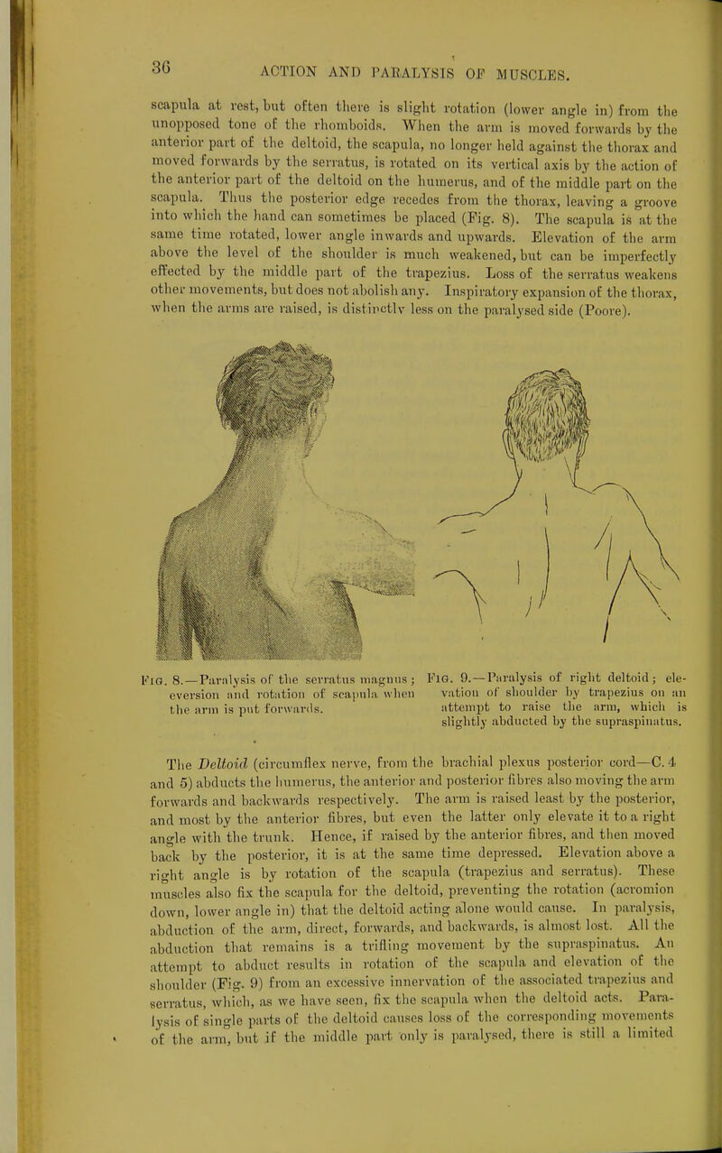 t ACTION AND PARALYSIS OF MUSCLES. scapula at rest, but often there is slight rotation (lower angle in) from the unopposed tone of the rhomboids. When the arm is moved forwards by the anterior part of the deltoid, the scapula, no longer held against the thorax and moved forwards by the serratus, is rotated on its vertical axis by the action of the anterior part of the deltoid on the humerus, and of the middle part on the .scapula. Thus the posterior edge recedes from the thorax, leaving a groove into which the hand can sometimes be placed (Fig. 8). The scapula is at the same time rotated, lower angle inwards and upwards. Elevation of the arm above the level of the shoulder is much weakened, but can be imperfectly effected by the middle part of the trapezius. Loss of the serratus weakens other movements, but does not abolish any. Inspiratory expansion of the thorax, when the arms are raised, is distinctly less on the paralysed side (Poore). FiG. 8.—Paralysis of the serratus maguus ; FlG. 9.—Paralysis of right deltoid; ele- eversion and rotation of scapula when vation of shoulder by trapezius on an the arm is put forwards. attempt to raise the arm, which is slightly abducted by the supraspinatus. The Deltoid (circumflex nerve, from the brachial plexus posterior cord—C. 4 and 5) abducts the humerus, the anterior and posterior fibres also moving the arm forwards and backwards respectively. The arm is raised least by the posterior, and most by the anterior fibres, but even the latter only elevate it to a right angle with the trunk. Hence, if raised by the anterior fibres, and then moved back by the posterior, it is at the same time depressed. Elevation above a right angle is by rotation of the scapula (trapezius and serratus). These muscles also fix the scapula for the deltoid, preventing the rotation (acromion down, lower angle in) that the deltoid acting alone would cause. In paralysis, abduction of the arm, direct, forwards, and backwards, is almost lost. All the abduction that remains is a trifling movement by the supraspinatus. An attempt to abduct results in rotation of the scapula and elevation of the shoulder (Fig. 9) from an excessive innervation of the associated trapezius and serratus, which, as we have seen, fix the scapula when the deltoid acts. Para- lysis of single parts of the deltoid causes loss of the corresponding movements of the arm, but if the middle part only is paralysed, there is still a limited