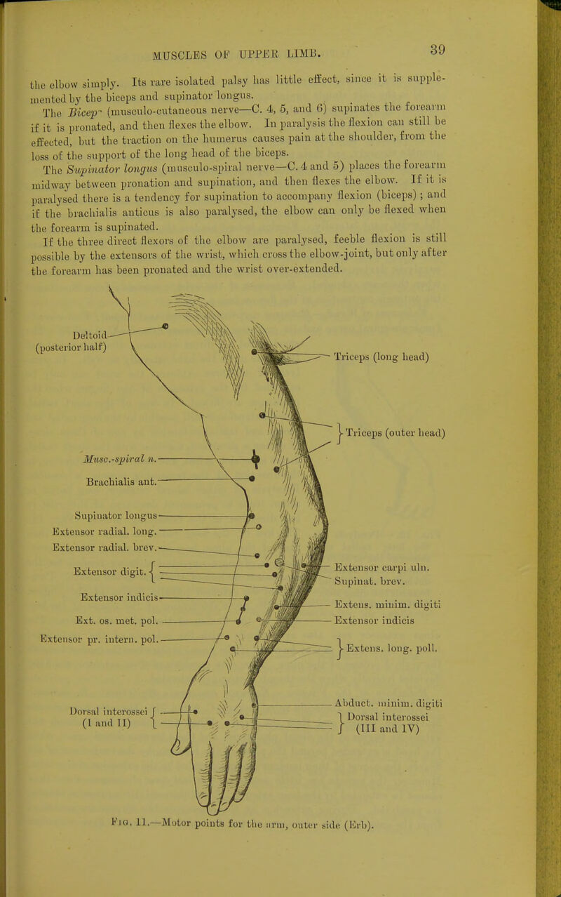 the elbow simply. Its rare isolated palsy has little effect, since it is supple- merited by the biceps and supinator longus. The Bicep- (musculocutaneous nerve—C. 4, 5, and 6) supinates the forearm if it is pronated, and then flexes the elbow. In paralysis the flexion can still be effected, but the traction on the humerus causes pain at the shoulder, from the loss of the support of the long head of the biceps. The Supinator longus (musculo-spiral nerve—C. 4 and 5) places the forearm midway between pronation and supination, and then flexes the elbow. If it is paralysed there is a tendency for supination to accompany flexion (biceps) ; and if the brachialis auticus is also paralysed, the elbow can only be flexed when the forearm is supinated. If the three direct flexors of the elbow are paralysed, feehle flexion is still possible by the extensors of the wrist, which cross the elbow-joint, but only after the forearm has heen pronated and the wrist over-extended. Deltoid (posterior half) Muse.-spiral n. Brachialis ant. Supinator longus Extensor radial, long. Extensor radial, brev. Extensor digit. Extensor indicis Ext. os. met. pol. Extensor pr. intern, pol. Dorsal interossei J (I and II) \ - Triceps (long head) j- Triceps (outer head) Extensor carpi uln. Supinat. brev. Extens. minim, digiti Extensor indicis | Exten s. long. poll. Abduct, minim, digiti 1 Dorsal interossei J (III and IV) Pig. 11.—Motor points for the arm, outer side (Erb).