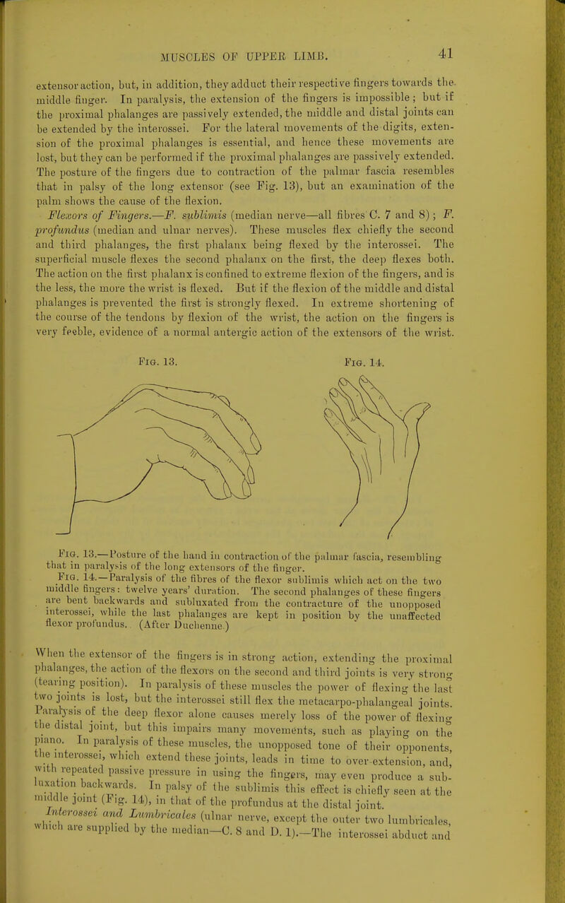 extensor action, but, in addition, they adduct their respective lingers towards the. middle finger. In paralysis, the extension of the fingers is impossible; but if the proximal phalanges are passively extended, the middle and distal joints can be extended by the interossei. For the lateral movements of the digits, exten- sion of the proximal phalanges is essential, and hence these movements are lost, but they can be performed if the proximal phalanges are passively extended. The posture of the fingers due to contraction of the palmar fascia resembles that in palsy of the long extensor (see Fig. 13), but an examination of the palm shows the cause of the flexion. Flexors of Fingers.—F. sublimis (median nerve—all fibres'C. 7 and 8); F. profundus (median and ulnar nerves). These muscles flex chiefly the second and third phalanges, the first phalanx being flexed by the interossei. The superficial muscle flexes the second phalanx on the first, the deep flexes both. The action on the first phalanx is confined to extreme flexion of the fingers, and is the less, the more the wrist is flexed. But if the flexion of the middle and distal phalanges is prevented the first is strongly flexed. In extreme shortening of the course of the tendons by flexion of the wrist, the action on the fingers is very feeble, evidence of a normal antergic action of the extensors of the wrist. Pig. 13. Fig. 14. Fig. 13.—Posture of the hand in contraction of the palmar fascia, resembling that in paralysis of the long extensors of the finger. Fig. 14.—Paralysis of the fibres of the flexor sublimis which act on the two middle fingers: twelve years' duration. The second phalanges of these fingers are bent backwards and subluxated from the contracture of the unopposed interossei, while the last phalanges are kept in position by the unaffected flexor profundus. (After Duchenne ) When the extensor of the lingers is in strong action, extending the proximal phalanges, the action of the flexors on the second and third joints is very strong (tearing position). In paralysis of these muscles the power of flexing the last two joints is lost, but the interossei still flex the metacarpophalangeal joints. Paralysis of the deep flexor alone causes merely loss of the power of flexing the distal joint, but this impairs many movements, such as playing on the piano In paralysis of these muscles, the unopposed tone of their opponents, the interossei, which extend these joints, leads in time to over-extension, and with repeated passive pressure in using the fingers, may even produce a sub- Laxation backwards. In palsy of 1 he sublimis this effect is chiefly seen at the middle joint (Fig. 11,, in that of the profundus at the distal joint. Merossez and Lumhricales (ulnar nerve, except the outer two lumbrieales, which are supplied by the median-C. 8 and D. l)._The interossei abduct and