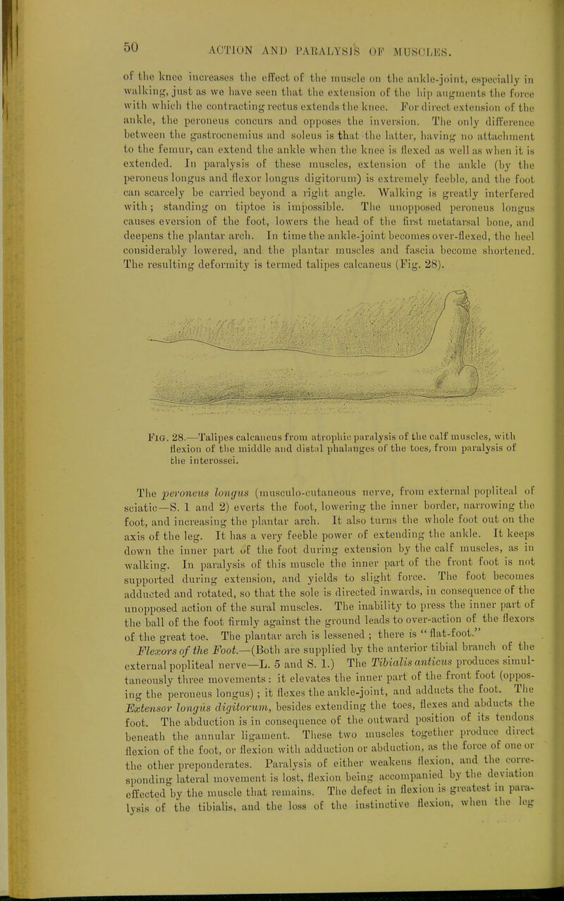 of the knee increases the effect of bhe muscle on the ankle-joint, especially in walking, just as we have seen that the extension of. the hip augments the Force with which the contracting rectus extends the knee. For direct extension of the ankle, the peroneus concurs and opposes the inversion. The only difference between the gastrocnemius and soleus is that the latter, having no attachment to the femur, can extend the ankle when the knee is Hexed as well as when it is extended. In paralysis of these muscles, extension of the ankle (by the peroneus longus and flexor longus digitorum) is extremely feeble, and the foot ran scarcely be carried beyond a right angle. Walking is greatly interfered with; standing on tiptoe is impossible. The unopposed peroneus longus causes eversion of the foot, lowers the bead of the first metatarsal bone, and deepens the plantar arch. In time the ankle-joint becomes over-flexed, the heel considerably lowered, and the plantar muscles and fascia become shortened. The resulting deformity is termed talipes calcaneus (Fig. 28). I Fig. 28.—Talipes calcaneus from atrophic paralysis of the calf muscles, with flexion of the middle and distal phalanges of the toes, from paralysis of the interossei. The peroneus longus (musculo-cutaneous nerve, from external popliteal of sciatic—S. 1 and 2) everts the foot, lowering the inner border, narrowing the foot, and increasing the plantar arch. It also turns the whole foot out on the axis of the leg. It has a very feeble power of extending the ankle. It keeps down the inner part of the foot during extension by the calf muscles, as in walking. In paralysis of this muscle the inner part of the front foot is not supported during extension, and yields to slight force. The foot becomes adducted and rotated, so that the sole is directed inwards, in consequence of the unopposed action of the sural muscles. The inability to press the inner part of the ball of the foot firmly against the ground leads to over-action of the flexors of the great toe. The plantar arch is lessened ; there is  flat-foot. Flexors of the Foot.—(Both are supplied by the anterior tibial branch of the external popliteal nerve—L. 5 and S. 1.) The Tibialis anticus produces simul- taneously three movements: it elevates the inner part of the front foot (oppos- ing the peroneus longus) ; it Ilexes the ankle-joint, and adducts the foot. The Extensor longus digitorum, besides extending the toes, ilexes and abducts the foot. The abduction is in consequence of the outward position of its tendons beneath the annular ligament. These two muscles together produce direct flexion of the foot, or flexion with adduction or abduction, as the force of one or the other preponderates. Paralysis of either weakens flexion, and the corre- sponding lateral movement is lost, flexion being accompanied by the deviation effected by the muscle that remains. The defect in flexion is greatest in para- ly.is of the tibialis, and the loss of the instinctive flexion, when the leg