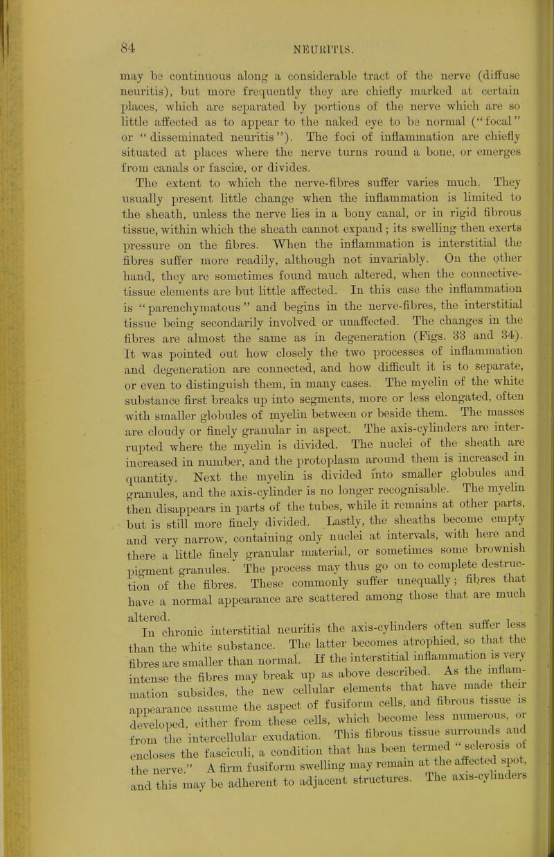 may be continuous along a considerable tract of the nerve (diffuse neuritis), but more frequently they are chiefly marked at certain places, which are separated by portions of the nerve which are so little affected as to appear to the naked eye to be normal (focal or disseminated neuritis). The foci of inflammation are chiefly situated at places where the nerve turns round a bone, or emerges from canals or fasciae, or divides. The extent to which the nerve-fibres suffer varies much. They usually present little change when the inflammation is limited to the sheath, unless the nerve lies in a bony canal, or in rigid fibrous tissue, within which the sheath cannot expand; its swelling then exerts pressure on the fibres. When the inflammation is interstitial the fibres suffer more readily, although not invariably. On the other hand, they are sometimes found much altered, when the connective- tissue elements are but little affected. In this case the inflammation is parenchymatous and begins in the nerve-fibres, the interstitial tissue being secondarily involved or unaffected. The changes in the fibres are almost the same as in degeneration (Figs. 33 and 34). It was pointed out how closely the two processes of inflammation and degeneration are connected, and how difficult it is to separate, or even to distinguish them, in many cases. The myelin of the white substance first breaks up into segments, more or less elongated, often with smaller globules of myelin between or beside them. The masses are cloudy or finely granular in aspect. The axis-cylinders are inter- rupted where the myelin is divided. The nuclei of the sheath are increased in number, and the protoplasm around them is increased in quantity. Next the myehn is divided into smaller globules and granules, and the axis-cylinder is no longer recognisable. The myelin then disappears in parts of the tubes, while it remains at other parts, but is still more finely divided. Lastly, the sheaths become empty and very narrow, containing only nuclei at intervals, with here and there a little finely granular material, or sometimes some brownish pigment granules. The process may thus go on to complete destruc- tion of the fibres. These commonly suffer unequally; fibres that have a normal appearance are scattered among those that are much elite reel In chronic interstitial neuritis the axis-cylinders often suffer less than the white substance. The latter becomes atrophied, so that the fibres are smaller than normal. If the interstitial inflammation is very intense the fibres may break up as above described As the inflam- mation subsides, the new cellular elements that have made then appearance assume the aspect of fusiform cells, and fibrous tissue i developed, either from these cells, wind, become less numerous, or from the intercellular exudation. This fibrous tissue surrounds and encloses the fasciculi, a condition that has been termed sclerosi of ihe nerve  A firm fusiform swelling may remain at the affected spot, and this may be adherent to adjacent structures. The axis-cylmders
