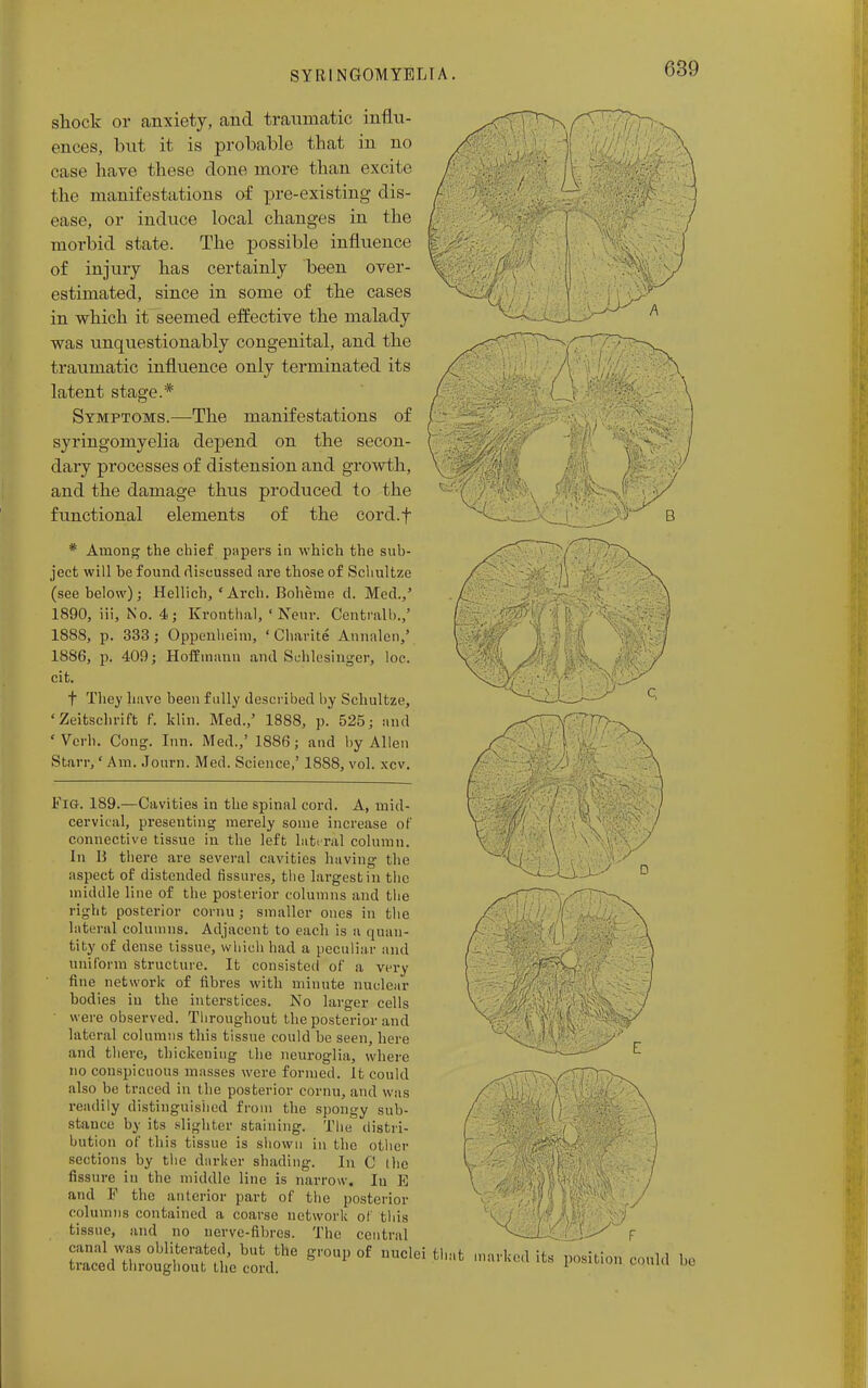 shock or anxiety, and traumatic influ- ences, but it is probable that in no case have these clone more than excite the manifestations of pre-existing dis- ease, or induce local changes in the morbid state. The possible influence of injury has certainly been over- estimated, since in some of the cases in which it seemed effective the malady was unquestionably congenital, and the traumatic influence only terminated its latent stage.* Symptoms.—The manifestations of syringomyelia depend on the secon- dary processes of distension and growth, and the damage thus produced to the functional elements of the cord.f * Among the chief papers in which the sub- ject will be found discussed are those of Scliultze (see below); Hellich, ' Arch. Boheme d. Med.,5 1890, iii, No. 4; Kronthat, 1 New. Central!).,' 1888, p. 333 ; Oppcnheim, ' Charite Annalen,' 1886, p. 409; Hoffmann and Sehlesinger, loc. cit. t They have been fully described by Schultze, 'Zeitschrift f. klin. Med.,' 1888, p. 525; and 'Vorh. Cong. Inn. Med.,' 1886; and by Allen Starr,' Am. J own. Med. Science,' 1888, vol. xcv. Fig. 189.—Cavities in the spinal cord. A, mid- cervical, presenting merely some increase of connective tissue in the left lateral column. In 15 there are several cavities having the aspect of distended fissures, the largest in the middle line of the posterior columns and the right posterior cornu; smaller ones in the lateral columns. Adjacent to each is a quan- tity of dense tissue, which had a peculiar and uniform structure. It consisted of a very fine network of fibres with minute nuclear bodies in the interstices. No larger cells were observed. Throughout the posterior and lateral columns this tissue could be seen, here and there, thickening the neuroglia, where no conspicuous masses were formed. It could also be traced in the posterior cornu, and was readily distinguished from the spongy sub- stance by its slighter staining. The distri- bution of this tissue is shown in the other sections by the darker shading. In C I be fissure in the middle line is narrow. In E and F the anterior part of the posterior columns contained a coarse network of this tissue, and no nerve-fibres. The central canal was obliterated, but the group of nuclei that traced throughout the cord.