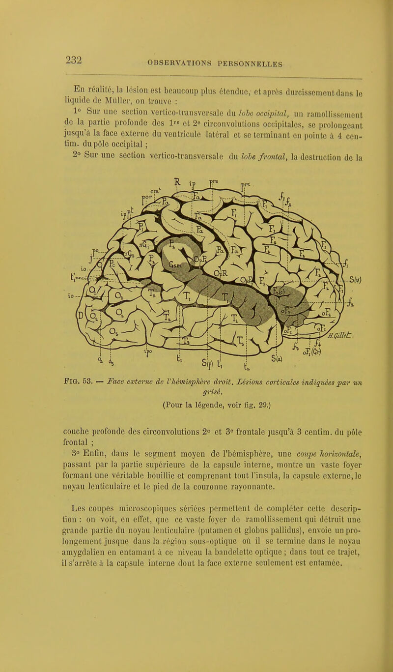 Ei) réalité; la lésion est beaucoup plus étendue, et après durcissement dans le liquide de MUller, on trouve : 1° Sur une section vertico-transversale du lobe occipital, un ramollissement de la partie profonde des 1 et 2» circonvolutions occipitales, se prolongeanl jusqu'à la face externe du ventricule latéral et se terminant on pointe à 4 cen- tim. du pôle occipital ; 2° Sur une section vertico-transversale du lobe frontal, la destruction de la Fig. 53. — Face externe de l'hémisphère droit. Lésions corticales indiquées par un grisé. (Pour la légende, voir fig. 29.) couche profonde des circonvolutions 2° et 3e frontale jusqu'à 3 centim. du pôle frontal ; 3° Enfin, dans le segment moyen de l'hémisphère, une coupe horizontale, passant par la partie supérieure de la capsule interne, montre un vaste foyer formant une véritable bouillie et comprenant tout l'insula, la capsule externe, le noyau lenticulaire et le pied de la couronne rayonnante. Les coupes microscopiques sériées permettent de compléter cette descrip- tion : on voit, en effet, que ce vaste foyer de ramollissement qui détruit une grande partie du noyau lenticulaire (putamen et globus pallidus), envoie un pro- longement jusque dans la région sous-optique où il se termine dans le noyau amygdalicn en entamant à ce niveau la bandelette optique ; dans tout ce trajet, il s'arrête à la capsule interne dont la face externe seulement est entamée.