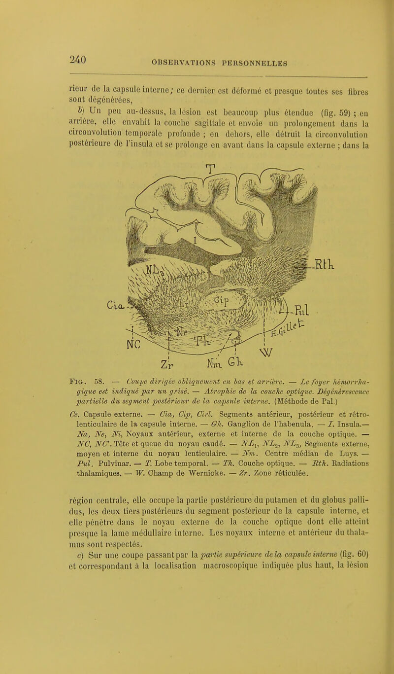 rieur de la capsule interne; ce dernier est déformé et presque toutes ses libres sont dégénérées, h) Un peu au-dessus, la lésion est beaucoup plus étendue (fig. 59) ; en arrière, elle envahit la couche sagittale et envoie un prolongement dans la circonvolution temporale profonde ; en dehors, elle détruit la circonvolution postérieure de l'insula et se prolonge en avant dans la capsule externe ; dans la Fig. 58. — Coupe dirigée obliquement en bas et arrière. —Le foyer Itèmorrha- gique est indiqué par un grisé. — Atrophie de la couche optique. Dégénérescence partielle du segment postérieur de la, capsule interne. (Méthode de Pal.) Ce. Capsule externe. — Cia, Cip, Cirl. Segments antérieur, postérieur et rétro- lenticulaire de la capsule interne. — 6fh. Ganglion de l'habenula. — I. Insula.— Na, Ne, Ni, Noyaux antérieur, externe et interne de la couche optique. — NC, N(. Tête et queue du noyau caudé. — NLU NL2, NZ3, Segments externe, moyen et interne du noyau lenticulaire. — Nm. Centre médian de Luys. — Pul. Pulvinar. — T. Lobe temporal. — Th. Couche optique. — Rth. Radiations thalamiques. — W. Champ de Wernicke. —Zr. Zone réticulée. région centrale, elle occupe la partie postérieure du putamen et du globus palli- dus, les deux tiers postérieurs du segment postérieur de la capsule interne, et elle pénètre dans le noyau externe de la couche optique dont clic atteint presque la lame médullaire interne. Les noyaux interne et antérieur du thala- mus sont respectés. c) Sur une coupe passant par \^ partie supérieure delà capsule interne (fig. 60) et correspondant à la localisation macroscopique indiquée plus haut, la lésion