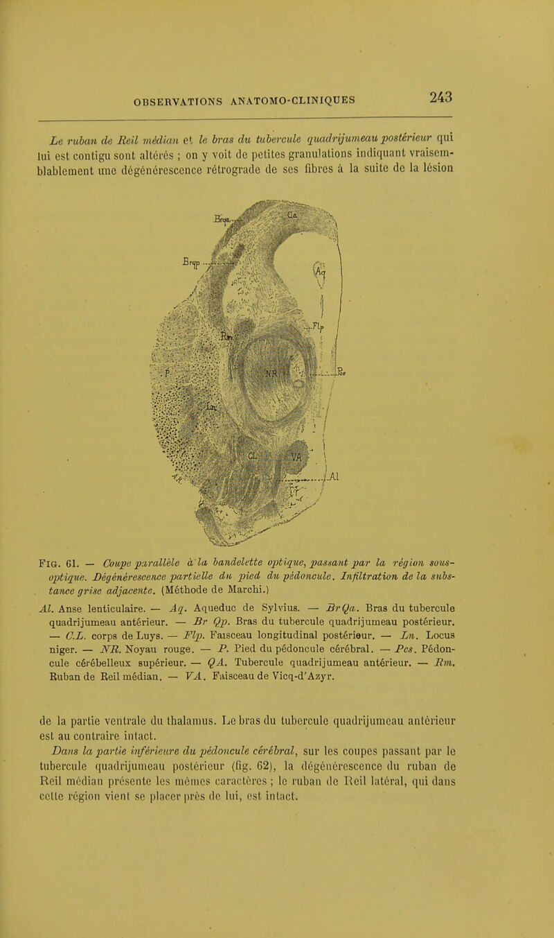 Le ruban de Reil médian et le bras du tubercule quadrijumeau postérieur qui lui est contigu sont altérés ; on y voit de petites granulations indiquant vraisem- blablement une dégénérescence rétrograde de ses fibres à la suite de la lésion Fig. 61. — Coupe parallèle a la bandelette optique, passant par la région sou-s- optique. Dégénérescence partielle du pied du -pédoncule. Infiltration de la subs- tance grise adjacente. (Méthode de Marchi.) Al. Anse lenticulaire. — Aq. Aqueduc de Sylviua. — BrQa. Bras du tubercule quadrijumeau antérieur. — Br Qp. Bras du tubercule quadrijumeau postérieur. — CL. corps de Luys. — Flp. Faisceau longitudinal postérieur. — Ln. Locus niger. — NR. Noyau rouge. — P. Pied du pédoncule cérébral. — Pcs. Pédon- cule cérébelleux supérieur. — ÇA. Tubercule quadrijumeau antérieur. — Rm. Ruban de Reil médian. — VA. Faisceau de Vicq-d'Azyr. de la partie ventrale du thalamus. Le bras du tubercule quadrijumeau antérieur est au contraire intact. Dans la partie inférieure du pédoncule cérébral, sur les coupes passant par le tubercule quadrijumeau postérieur (fig. 62), la dégénérescence (lu ruban de Reil médian présente les mêmes caractères ; le ruban de Reil latéral, qui dans celte région vient se placer près de lui, est intact.