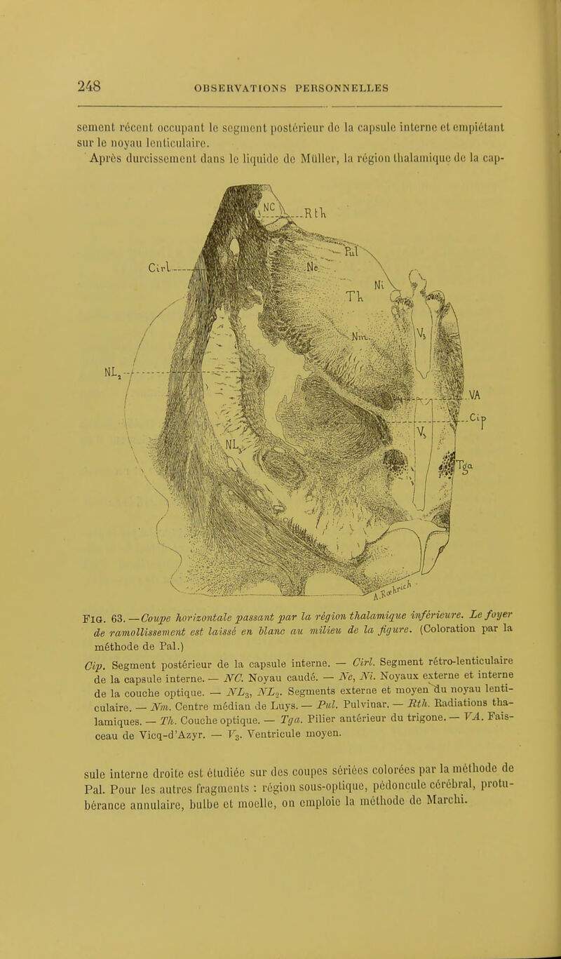 senicnl récent occupant le segment postérieur de la capsule interne et empiétant sur le noyau lenticulaire. Après durcissement dans le liquide de Miiller, la région lhalamiquede la cap- FlO. 63. — Coupe horizontale passant par la région thalamique inférieure. Le foyer de ramollissement est laissé en liane au milieu de la figure. (Coloration par la méthode de Pal.) Cip. Segment postérieur de la capsule interne. — Cirl. Segment rétro-lenticulaire de la capsule interne. — NC. Noyau caudé. — Ne, M. Noyaux externe et interne de la couche optique. — WLS, ArL2. Segments externe et moyen ^iu noyau lenti- culaire. — Nm. Centre médian de Luys. — Pul. Pulvinar. — Rth. Radiations tha- lamiques. — Th. Couche optique. — Tga. Pilier antérieur du trigone. — VA. Fais- ceau de Vicq-d'Azyr. — V3. Ventricule moyen. suie interne droite est étudiée sur des coupes sériées colorées par la méthode Pal. Pour les autres fragments : région sous-optique, pédoncule cérébral, pro bérance annulaire, bulbe et moelle, on emploie la mélbotlc de Marehi.