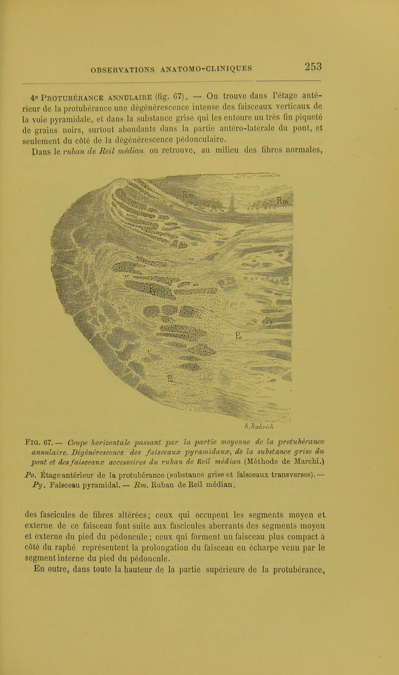 4» Protubérance annulaire (fig. G7). — On trouve dans l'étage anté- rieur de la protubérance une dégénérescence intense des faisceaux verticaux de la voie pyramidale, el dans la substance .m ise qui les entoure un très fin piqueté de grains noirs, surtout abondants dans la partie antéro-latérale du pont, et seulement du côté de la dégénérescence pédonculaire. Dans le ruban de Reil médian on retrouve, au milieu des libres normales, Fig. 67. — Coupe horizontale passant par ^a partie moyenne de la protubérance annulaire. Dégénérescence des faisceaux pyramidaux, de la stibstance grise du pont et des faisceaux accessoires du ruban de Reil médian (Méthode de Marchi.) Po. Étage antérieur de la protubérance (substance grise et faisceaux transverses).— Py. Faisceau pyramidal.— Rm. Ruban de Reil médian. des fascicules de fibres altérées; ceux qui occupent les segments moyen et externe de ce faisceau font suite aux fascicules aberrants des segments moyen et externe du pied du pédoncule; ceux qui forment un faisceau plus compact à côté du raphé représentent la prolongation du faisceau en ècharpe venu par le segment interne du pied du pédoncule. En outre, dans toute la hauteur de la partie supérieure de la protubérance,