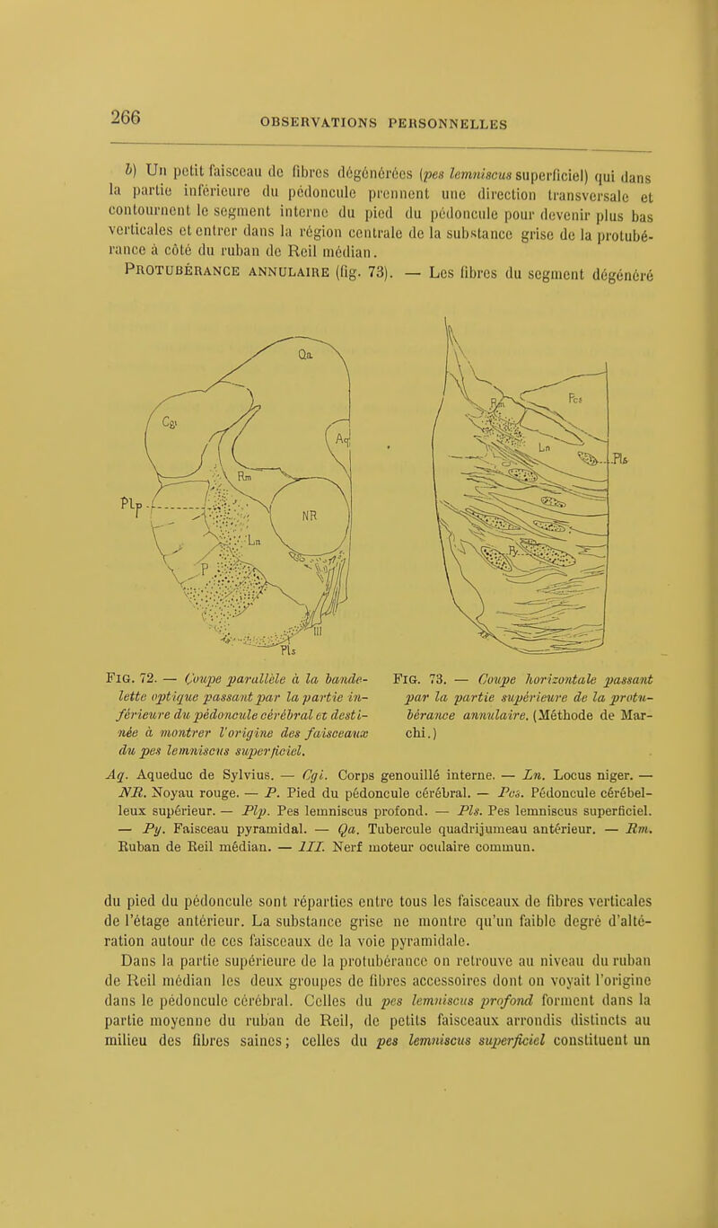 h) Un petit faisceau de fibres dégénérées (pes lemniscus superficiel) qui dans la partie inférieure du pédoncule prennent une direction transversale et contournent le segment interne du pied du pédoncule pour devenir plus bas verticales et entrer dans la région centrale de la substance grise de la protubé- rance à côté du ruban de Reil médian. Protubérance annulaire (fig. 73). — Les libres du segment dégénéré Fig. 72. — Çoupe parallèle à la bande- FiG. 73. — Coupe horizontale passant lette optique passant par la partie in- par la partie supérieure de la protu- férieure du pédoncule cérébral et destl- bérance annulaire. (Méthode de Mar- née à montrer l'origine des faisceaux chi.) du pes lemniscus superficiel. Aq. Aqueduc de Sylvius. — Cgi. Corps genouillé interne. — Ln. Locus niger. — NR. Noyau rouge. — P. Pied du pédoncule cérébral. — Pes. Pédoncule cérébel- leux supérieur. — Plp. Pes lemniscus profond. — Pis. Pes lemniscus superficiel. — Py. Faisceau pyramidal. — Qa. Tubercule quadrijumeau antérieur. — Rm. Euban de Reil médian. — III. Nerf moteur oculaire commun. du pied du pédoncule sont réparties entre tous les faisceaux de fibres verticales de l'étage antérieur. La substance grise ne montre qu'un faible degré d'alté- ration autour de ces faisceaux de la voie pyramidale. Dans la partie supérieure de la protubérance on retrouve au niveau du ruban de Reil médian les deux groupes de fibres accessoires dont on voyait l'origine dans le pédoncule cérébral. Celles du pes lemniscus profond forment dans la partie moyenne du ruban de Reil, de petits faisceaux arrondis distincts au milieu des fibres saines ; celles du pes lemniscus superficiel constituent un