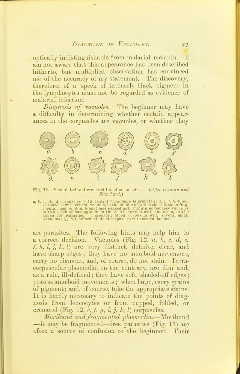 optically indistinguishable from malarial melanin. I am not aware that this appearance has been described hitherto, but multiplied observation has convinced me of the accuracy of my statement. The discovery, therefore, of a speck of intensely black pigment in the lymphocytes must not be regarded as evidence of malarial infection. Diagnosis of vacuoles The beginner may have a difficulty in determining whether certain appear- ances in the corpuscles are vacuoles, or whether they Fig. 12.—Vacuolated and crenated blood corpuscles. {After Laveran and Blanchard.) a, b, c, blood corpuscles with central vacuoles, c is crenated; d, e, /, li, blood corpuscles with central vacuole, in the middle of which there is some fnife'- mental hajinofloliin. Sometimes exceedinglj- minute egg-shapeil vacuoles ■with a speck o£ hemoglobin in the centre are met with, and are apt to be taken for parasites, g, crenated blood corpuscle with several small vacuoles; i, j, Ic, I, deformed blood corpuscles with central laciiniB. are parasites. The following hints may help him to a correct decision. Vacuoles (Fig. 12, a, b, c, d, e, f, h, i,j, k, I) are very distinct, deBnite, clear, and have sharp edges ; they have no amoeboid movement, carry no pigment, and, of course, do not stain. Intra- corpuscular plasmodia, on the contrary, are dim and, as a rule, ill-defined; they have soft, shaded-off edges ; possess amoeboid movements; when large, carry grains of pigment; and, of course, take the appropriate stains. It is hardly necessary to indicate the points of diag- nosis from leucocytes or from cupped, folded, or crenated (Fig. 12, c,/, g, i, j, k, I) corpuscles. Moribund and fragmented 2ilcismodia.—Moribund —it may be fragmented—free parasites (Fig. 13) are often a source of confusion to the beginner. Their