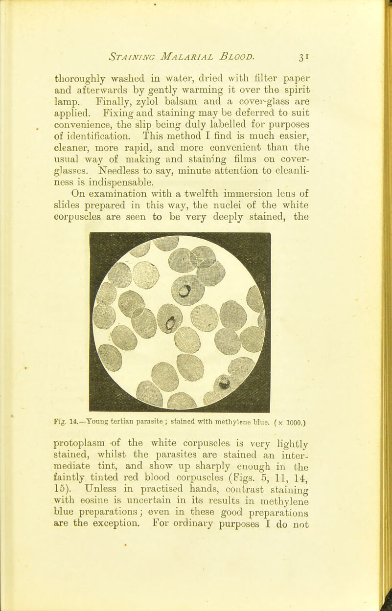 thoroughly washed in water, dried with filter paper and afterwards by gently warming it over the spirit lamp. Finally, zylol balsam and a cover-glass are applied. Fixing and staining may be deferi-ed to suit convenience, the slip being duly labelled for purposes of identification. This method I find is much easier, cleaner, more rapid, and more convenient than the usual way of making and stain'jng films on cover- glasses. iN'eedless to say, minute attention to cleanli- ness is indispensable. On examination with a twelfth immersion lens of slides prepared in this way, the nuclei of the white coi'puscles are seen to be very deeply stained, the Fig. 14.—Young tertian parasite ; stained with methylene blue. (x 1000.) protoplasm -of the white corpuscles is very lightly stained, whilst the parasites are stained an inter- mediate tint, and show up sharply enough in the faintly tinted red blood corpuscles (Figs. 5, 11, 14, 15). Unless in practised hands, contrast staining with eosine is uncertain in its results in methylene blue preparations; even in these good preparations are the exception. For ordinary purposes I do not