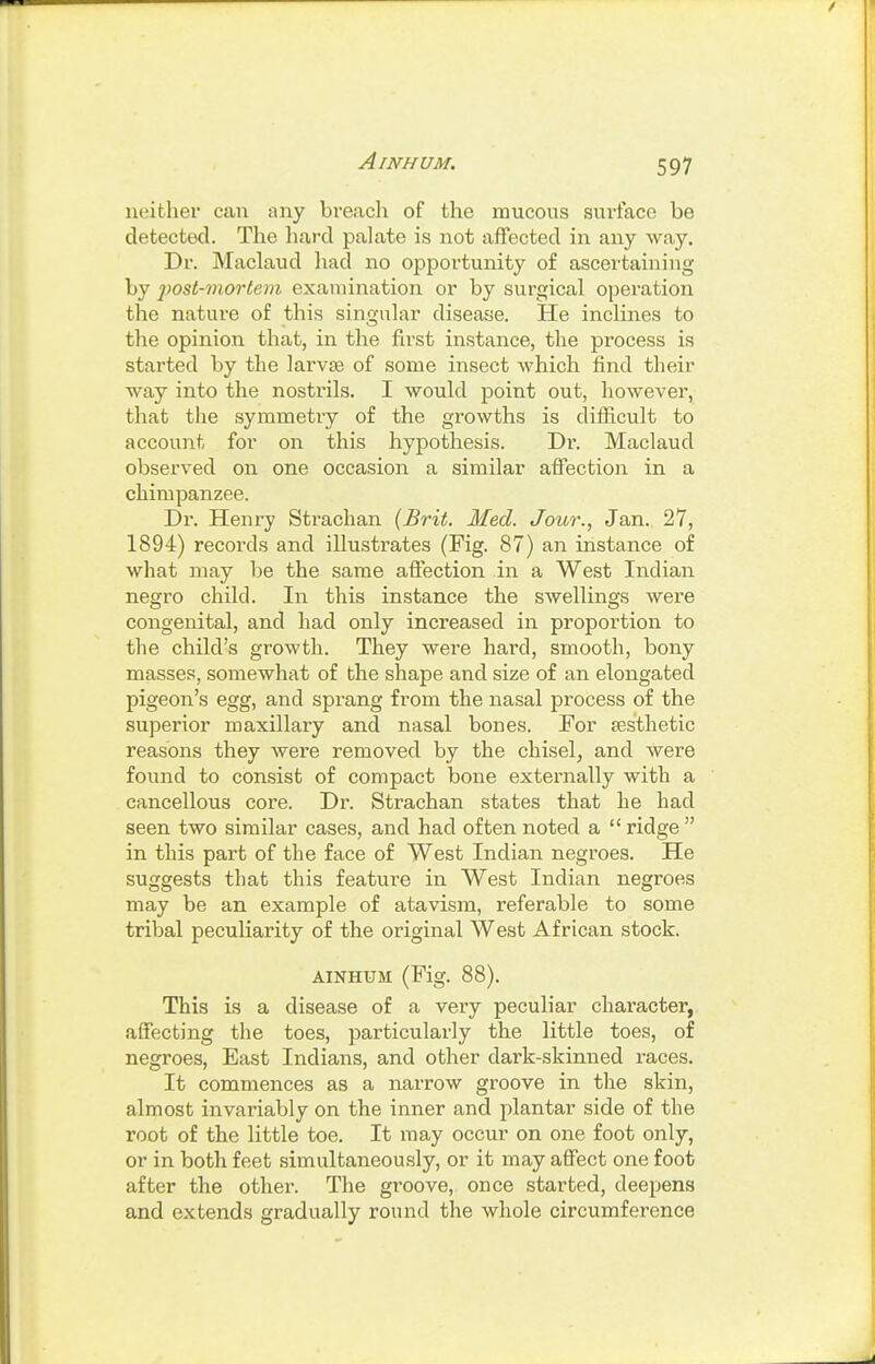 neither can any bi'each of the mucous surface be detected. The hard palate is not affected in any way. Dr. Maclaud liad no oppoi'tunity of ascertaining by 'post-mortem examination or by surgical operation the nature of this singular disease. He inclines to the opinion that, in the first instance, the process is started by the larvse of some insect which find their way into the nostrils. I would point out, however, that the symmetry of the growths is difficult to account for on this hypothesis. Dr. Maclaud observed on one occasion a similar affection in a chimpanzee. Dr. Henry Strachan {Brit. Med. Jour., Jan. 27, 1894) records and illustrates (Fig. 87) an instance of what may be the same aftection in a West Indian negro child. In this instance the swellings were congenital, and had only increased in proportion to the child's growth. They were hard, smooth, bony masses, somewhat of the shape and size of an elongated pigeon's egg, and sprang from the nasal process of the superior maxillary and nasal bones. For sesthetic reasons they were removed by the chisel, and were found to consist of compact bone externally with a cancellous core. Dr. Strachan states that he had seen two similar cases, and had often noted a  ridge  in this part of the face of West Indian negroes. He suggests that this feature in West Indian negroes may be an example of atavism, referable to some tribal peculiarity of the original West African stock. AINHUM (Fig. 88). This is a disease of a very peculiar character, affecting the toes, particularly the little toes, of negroes. East Indians, and other dark-skinned races. It commences as a narrow groove in the skin, almost invariably on the inner and plantar side of the root of the little toe. It may occur on one foot only, or in both feet simultaneously, or it may affect one foot after the other. The groove, once started, deepens and extends gradually round the whole circumference