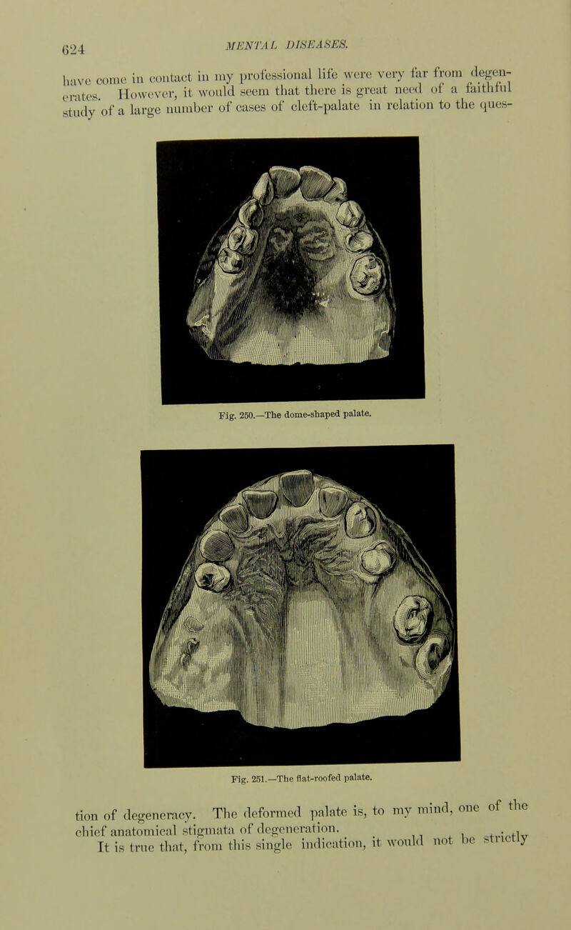 MENTAL DISK A SEK haVe come in contact in my professional life were very far from degen^ erates However, it would seem that there is great need oi a taitntnJ study of a large number of eases of cleft-palate in relation to the ques- Fig. 250.—The dome-shaped palate. Fig. 251.—The flat-roofed palate. tion of degeneracy. The deformed palate is, to my mind, one of the chief anatomical stigmata of degeneration. d4.„;„+w It is true that, from this single indication, it would not be strictlj