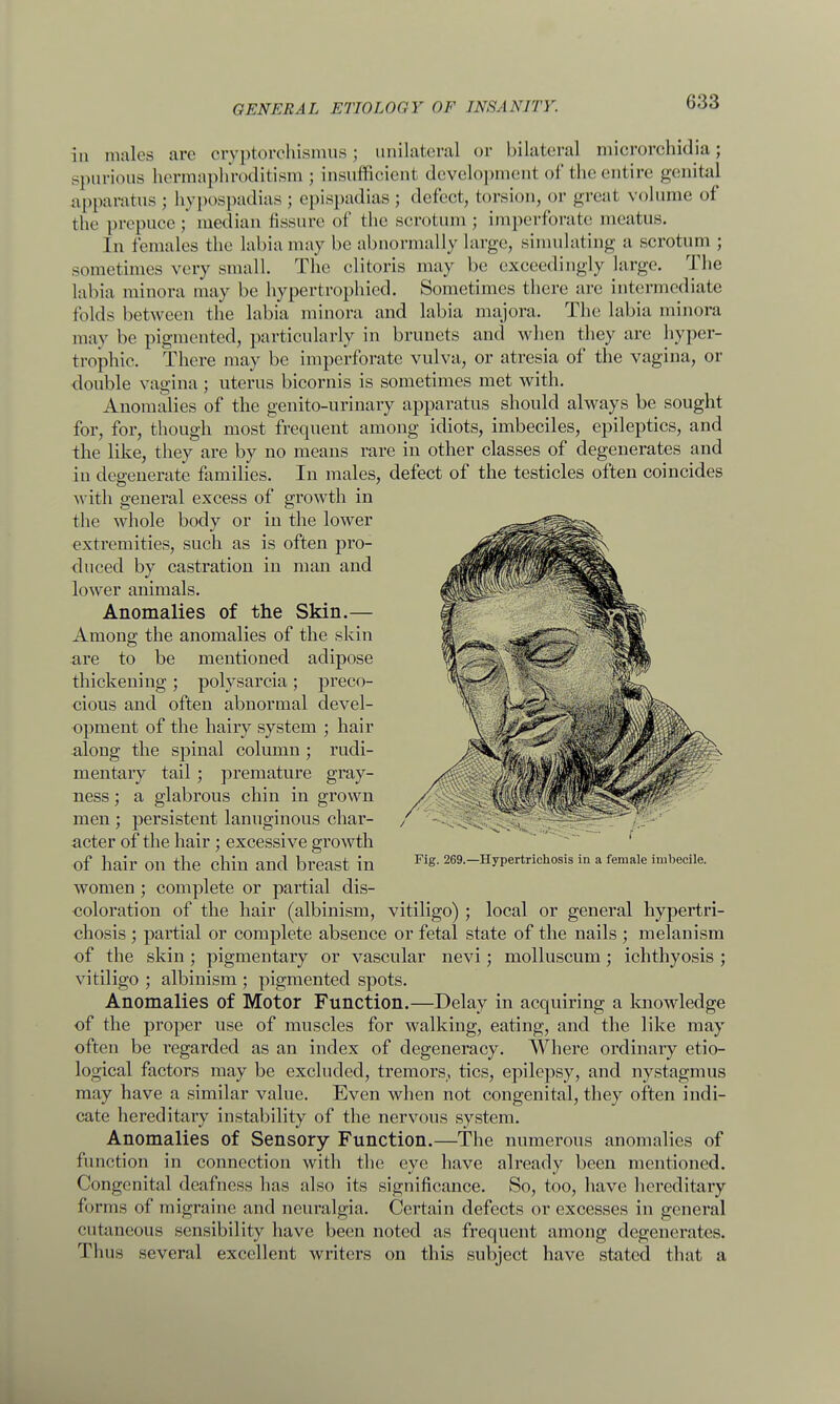 in males are oryptorohismus; unilateral or bilateral microrchidia; spurious hermaphroditism; insumoierri developmenl of the entire genital apparatus ; hypospadias ; epispadias ; defect, torsion, or great volume of the prepuce;' median fissure of the scrotum ; imperforate meatus. In females the labia may be abnormally large, simulating a scrotum ; sometimes very small. The clitoris may be exceedingly large. The labia minora may be hypertrophied. Sometimes there are intermediate folds between the labia minora and labia majora. The labia minora may be pigmented, particularly in brunets and when they are hyper- trophic. There may be imperforate vulva, or atresia of the vagina, or double vagina ; uterus bicornis is sometimes met with. Anomalies of the genito-urinary apparatus should always be sought for, for, though most frequent among idiots, imbeciles, epileptics, and the like, they are by no means rare in other classes of degenerates and in degenerate families. In males, defect of the testicles often coincides with general excess of growth in the whole body or in the lower extremities, such as is often pro- duced by castration in man and lower animals. Anomalies of the Skin.— Among the anomalies of the skin are to be mentioned adipose thickening; polysarcia; preco- cious and often abnormal devel- opment of the hairy system ; hair along the spinal column ; rudi- mentary tail; premature gray- ness; a glabrous chin in grown men; persistent lanuginous char- / - -_.;:,0-, ; acter of the hair; excessive growth Of hair 011 the chin and breast in FiS- 269.-Hypertricb.osis in a female imbecile. women ; complete or partial dis- coloration of the hair (albinism, vitiligo) ; local or general hypertri- chosis ; partial or complete absence or fetal state of the nails ; melanism of the skin; pigmentary or vascular nevi; molluscum; ichthyosis ; vitiligo ; albinism ; pigmented spots. Anomalies of Motor Function.—Delay in acquiring a knowledge of the proper use of muscles for walking, eating, and the like may often be regarded as an index of degeneracy. Where ordinary etio- logical factors may be excluded, tremors,, tics, epilepsy, and nystagmus may have a similar value. Even when not congenital, they often indi- cate hereditary instability of the nervous system. Anomalies of Sensory Function.—The numerous anomalies of function in connection with the eye have already been mentioned. Congenital deafness has also its significance. So, too, have hereditary forms of migraine and neuralgia. Certain defects or excesses in general cutaneous sensibility have been noted as frequent among degenerates. Thus several excellent writers on this subject have stated that a