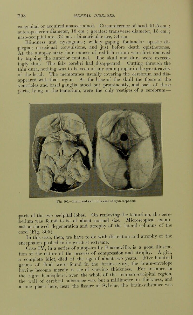 congenital or acquired unascertained. Circumference of head, 51.5 cm. ; anteroposterior diameter, 18 cm. ; greatest transverse diameter, 15 cm.; Qaso-occipital arc, 32 cm.; binauricular arc, 34 cm. Blindness and nystagmus; widely gaping fontanels; spastic di- plegia; occasional convulsions, and just before death opisthotonos. At the autopsy sixty-four ounces of reddish serum were first removed bv tapping the anterior fontanel. The skull and dura were exceed- ingly thin. The falx cerebri had disappeared. Cutting through the thin dura, nothing was to be seen of any brain proper in the great cavity of the head. The membranes usually covering the cerebrum had dis- appeared with that organ. At the base of the skull the floors of the ventricles and basal ganglia stood out prominently, and back of these parts, lying on the tentorium, were the only vestiges of a cerebrum— Fig. 305.—Brain and skull in a case of hydrocephalus. parts of the two occipital lobes. On removing the tentorium, the cere- bellum was found to be of about normal size. Microscopical exami- nation showed degeneration and atrophy of the lateral columns of the cord (Fig. 305). In this case, then, we have to do with distention and atrophy of the encephalon pushed to its greatest extreme. Case IV, in a series of autopsies by Bourneville, is a good illustra- tion of the nature of the process of compression and atrophy. A girl, a complete idiot, died at the age of about two years. Five hundred grams of fluid were found in the brain-cavity, the brain-envelope having become merely a sac of varying thickness. For instance, in the right hemisphere, over the whole of the temporo-occipital region, the wall of cerebral substance was but a millimeter in thickness, and at one place here, near the fissure of Sylvius, the brain-substance was