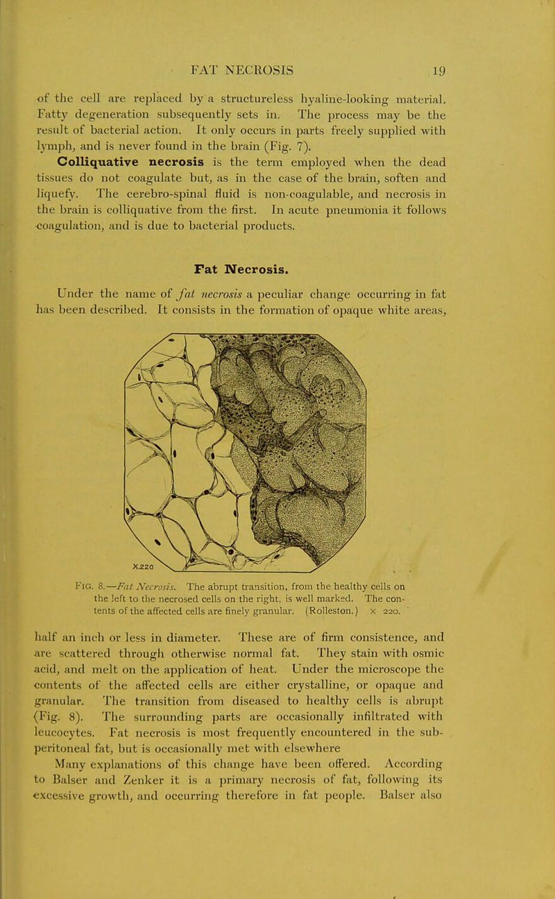of the cell are replaced by a structureless hyaline-looking material. Fatty degeneration subsequently sets in. The process may be the result of bacterial action. It only occurs in jwts freely supplied with lymph, and is never fomid in the brain (Fig. 7). Colliquative necrosis is the term employed when the dead tissues do not coagulate but, as in the case of the brain, soften and liquefy. The cerebro-spinal fluid is non-coagulable, and necrosis in the brain is colliquative from the first. In acute pneumonia it follows coagulation, and is due to bacterial products. Fat Necrosis. Under the name of fat necrosis a peculiar change occurring in fat has been described. It consists in the formation of opaque white areas. Fig. 8.—Fat Necrosis. The abrupt transition, from the healthy cells on the left to the necrosed cells on the right, is well marked. The con- tents of the affected cells are finely granular. (Rolleston.) x 220. half an inch or less in diameter. These ai-e of firm consistence, and are scattered through otherwise normal fat. They stain with osmic acid, and melt on the application of heat. Under the microscope the contents of the affected cells are either crystalline, or opaque and granular. The transition from diseased to healthy cells is abrupt (Fig. 8). The surrounding parts are occasionally infiltrated with leucocytes. Fat necrosis is most frequently encountered in the sub- peritoneal fat, but is occasionally met with elsewhere Many explanations of this change have been offered. According to Balser and Zenker it is a primary neci'osis of fat, following its excessive growth, and occurring therefore in fat people. Balser also