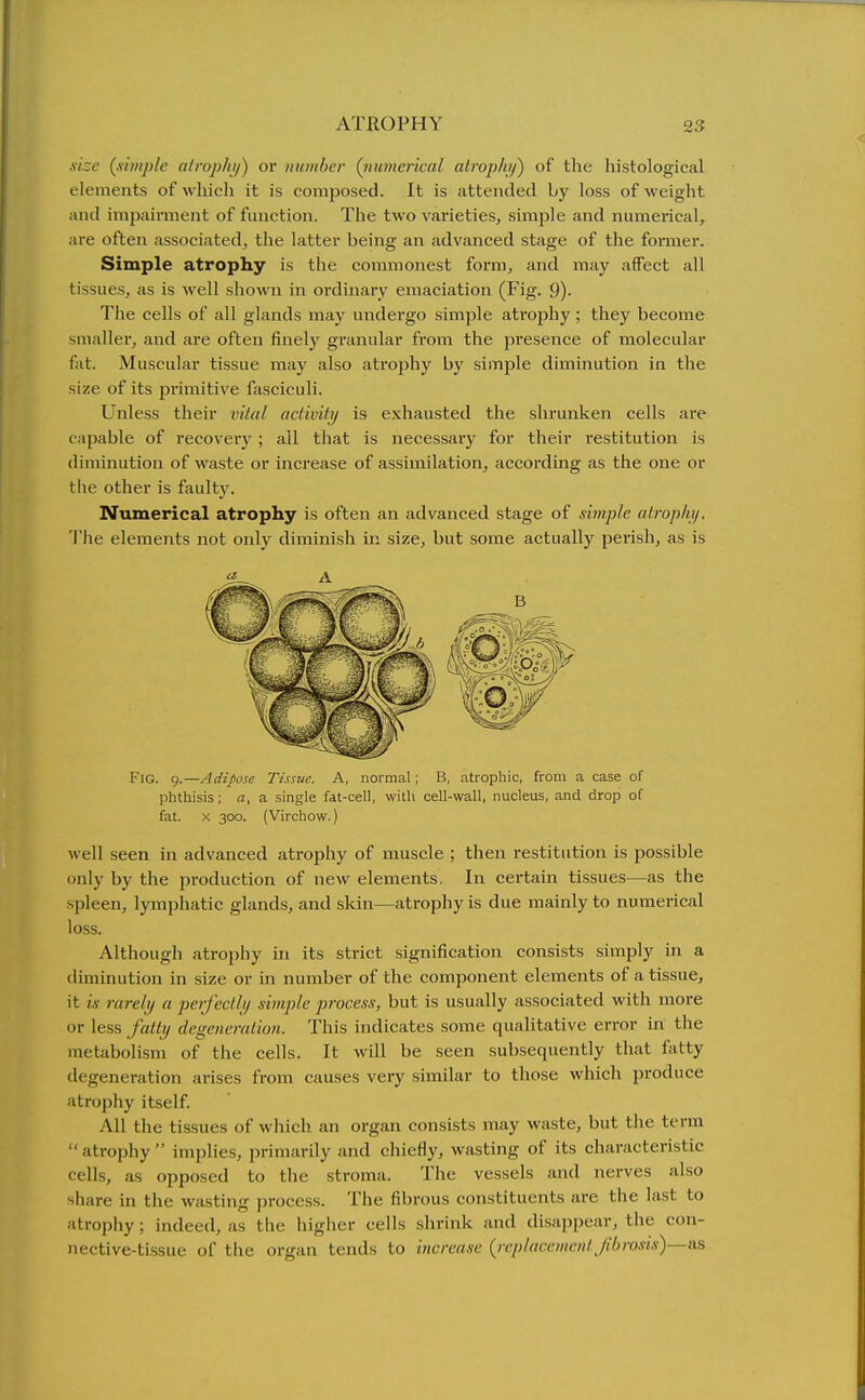 size {x'tmple alrophy) or number (iiumerical atrophy) of the histological elements of which it is composed. It is attended by loss of weight and impairment of function. The two varieties, simple and numerical, are often associated, the latter being an advanced stage of the former. Simple atrophy is the commonest form, and may affect all tissues, as is well shown in ordinary emaciation (Fig. 9)- The cells of all glands may undergo simple atrophy; they become smaller, and are often finely gi'anular from the presence of molecular fat. Muscular tissue may also atrophy by simple diminution in the size of its primitive fasciculi. Unless their vital activity is exhausted the shrunken cells are capable of recovery; all that is necessary for their restitution is diminution of waste or increase of assimilation, according as the one or the other is faulty. Numerical atrophy is often an advanced stage of simple atrophy. The elements not only diminish in size, but some actually perish, as is Fig. 9.—Adipose Tissue. A, normal; B, atrophic, from a case of phthisis; a, a single fat-cell, with cell-wall, nucleus, and drop of fat. X 300. (Virchow.) well seen in advanced atrophy of muscle ; then i-estitiition is possible only by the production of new elements. In certain tissues—as the spleen, lymphatic glands, and skin—atrophy is due mainly to numerical loss. Although atrophy in its strict signification consists simply in a diminution in size or in number of the component elements of a tissue, it is rarely a perfectly simple process, but is usually associated with more or less fatty degeneration. This indicates some qualitative error in the metabolism of the cells. It will be seen subsequently that fatty degeneration arises from causes very similar to those which produce atrophy itself All the tissues of which an organ consists may waste, but the term  atrophy  implies, primarily and chiefly, wasting of its characteristic cells, as opposed to the stroma. The vessels and nerves also share in the wasting process. The fibrous constituents are the last to atrophy; indeed, as the higher cells shrink and disappear, the con- nective-tissue of the organ tends to increase {replacement Jibrosis)—a.^