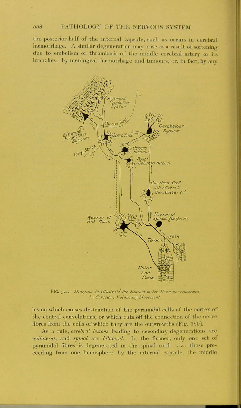 the posterior half of the interna] ca))sule, such as occurs in cerebral hiemon-hage. A similar degeneration may arise as a result of softening due to embolism or thrombosis of the middle cerebral artery or its branches ; by meningeal ha-morrhage and tumours, or, in fact, by any wiCh Afferent . CerebeUar Cri Neuron An( Ho Fig. 321.—Diagnim to illustralc the Scnsori-mvfor Xciirinics concerned ill Conscious I 'olun/aiy Movement. lesion which causes destruction of the pyramidal cells of the cortex of the central convolutions, or which cuts off the connection of the nerve fibres from the cells of which they are the outgrowths (Fig. ,'520). As a rule, cerebral le.sionx leading to secondary degenerations are unilateral, and spinal are Inlalcral. In the former, only one set of pyramidal fibres is degenerated in tile s])inal cord -viz., those pro- ceeding from one hemisphere by the internal capsule, the middle
