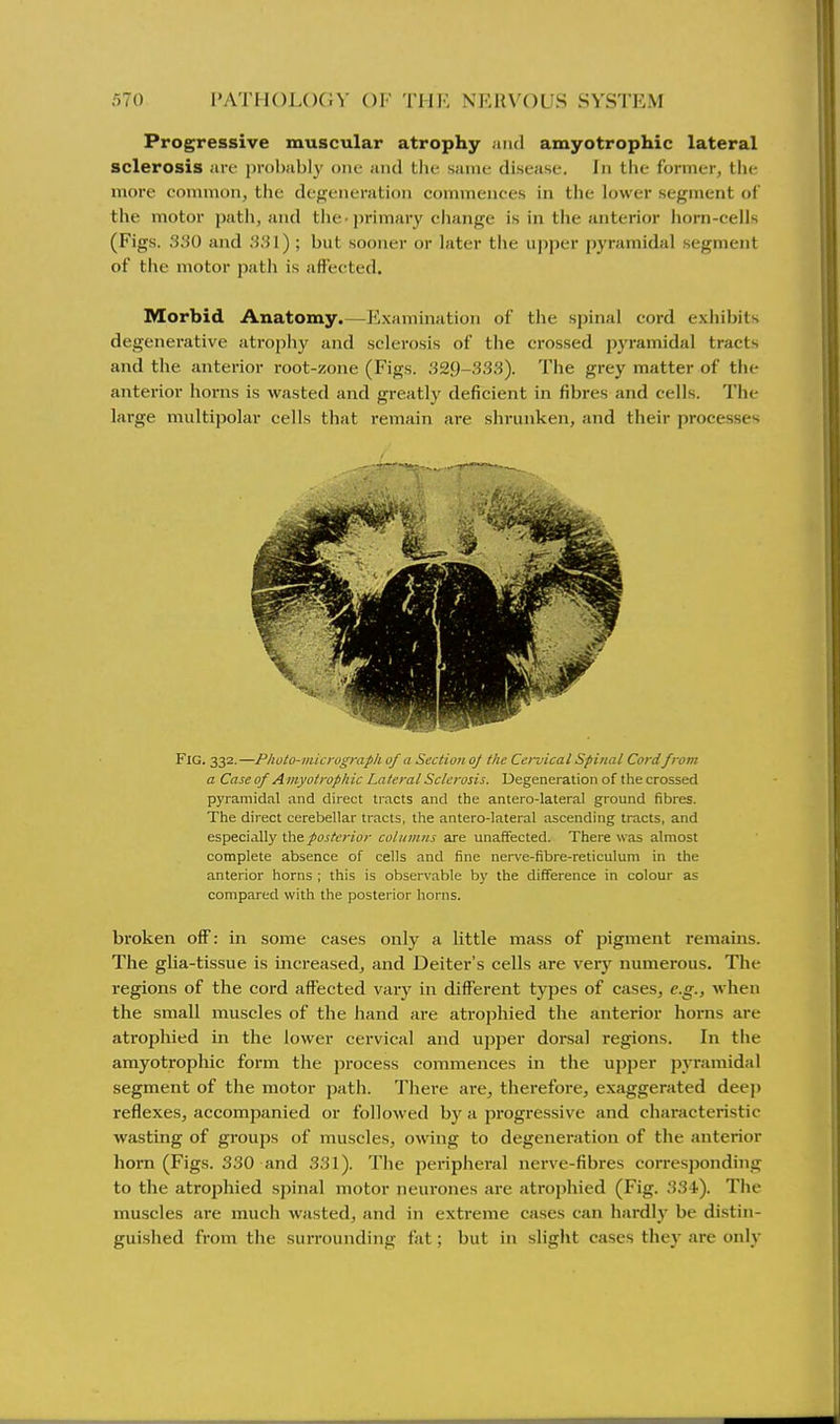 Progressive muscular atrophy and amyotrophic lateral sclerosis are probably one and tlit- same disease. In tlie former, the more common, the degeneration commences in the lower segment of the motor j>ath, and tlie^ primary change is in the anterior horn-cells (Figs. 330 and 331) ; but sooner or later the upper pyramidal segment of the motor path is affected. Morbid Anatomy.—Examination of the spinal cord exhibits degenerative atrophy and sclerosis of the crossed pyramidal tracts and the anterior root-zone (Figs. 329-333). The grey matter of the anterior horns is wasted and greatly deficient in fibres and cells. The large multipolar cells that remain are shrunken, and their processes Fig. 332.—Pholo-microgmph of a Section of the Cervical Spinal Cordfrom a Case of A myoirophic Lateral Sclerosis. Degeneration of the crossed pyramidal and direct tracts and the antero-lateral ground fibres. The direct cerebellar tracts, tlie antero-lateral ascending tracts, and especially the posterior columns are unaffected. There was almost complete absence of cells and fine nerve-fibre-reticulum in the anterior horns ; this is observable by the difference in colour as compared with the posterior horns. broken olF: in some cases only a little mass of pigment remains. The glia-tissue is increased, and Deiter's cells are very numerous. The regions of the cord affected vary in different types of cases, e.g., when the small muscles of the hand are atrophied the anterior horns are atrophied in the lower cervical and upper dorsal regions. In the amyotrophic form the process commences in the upper pyramidal segment of the motor path. There are, therefore, exaggerated deej) reflexes, accompanied or followed by a progressive and characteristic wasting of groups of muscles, owing to degeneration of the anterior hoi'n (Figs. 330 and 331). The peripheral nerve-fibres corresponding to the atrophied spinal motor neurones are atrophied (Fig. 334). The muscles are much wasted, and in extreme cases can hardly be distin- guished from the surrounding fat; but in slight cases they are only