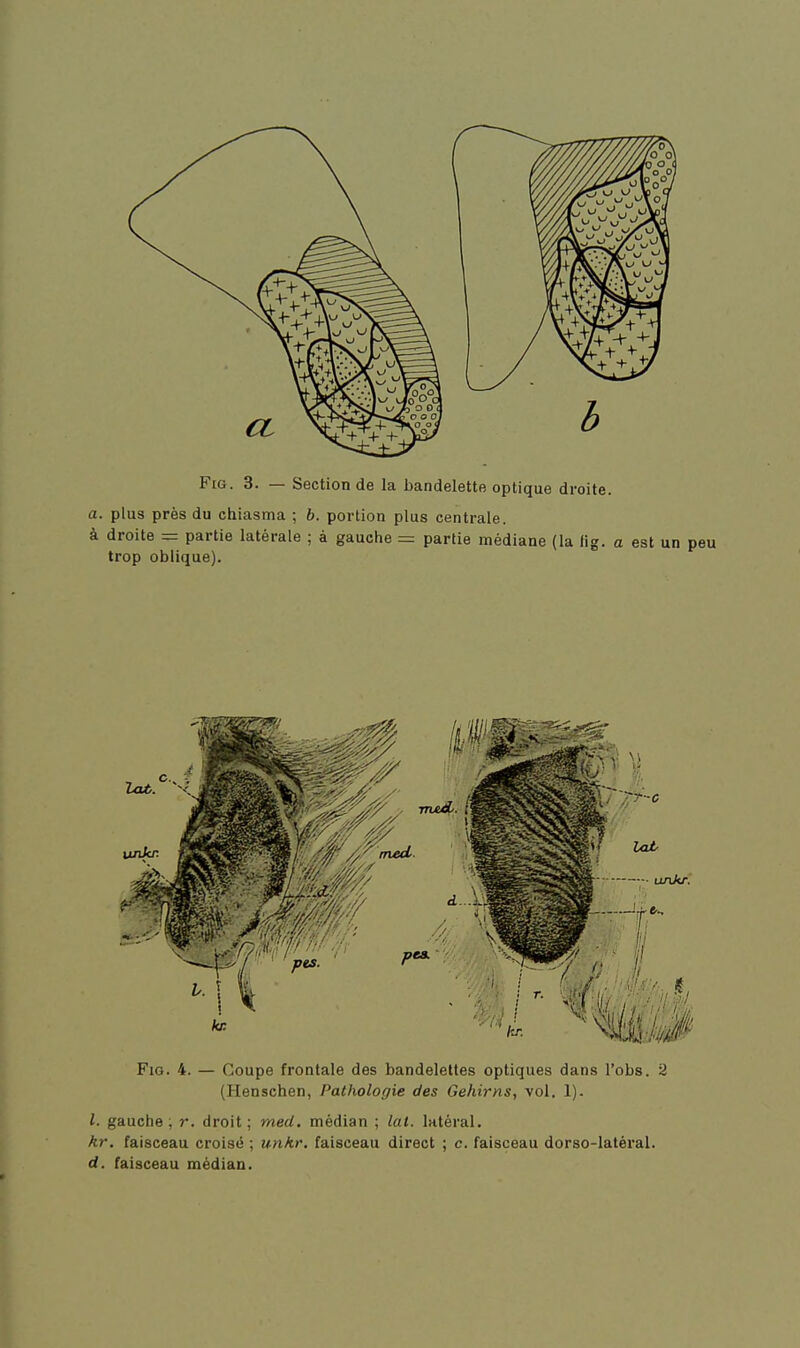 FiG. 3. — Section de la bandelette optique droite. a. plus près du chiasma ; b. portion plus centrale. à droite = partie latérale ; à gauche = partie médiane (la fig. a est un peu trop oblique). FiG. 4. — Coupe frontale des bandelettes optiques dans l'obs. 2 (Henschen, Pathologie des Gehirns, vol. 1). l. gauche ; r. droit ; med. médian ; lat. latéral. kr. faisceau croisé ; unkr. faisceau direct ; c. faisceau dorso-latèral. d. faisceau médian.