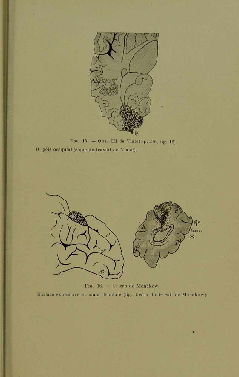 O. pôle occipital (copie du travail de Vialet).