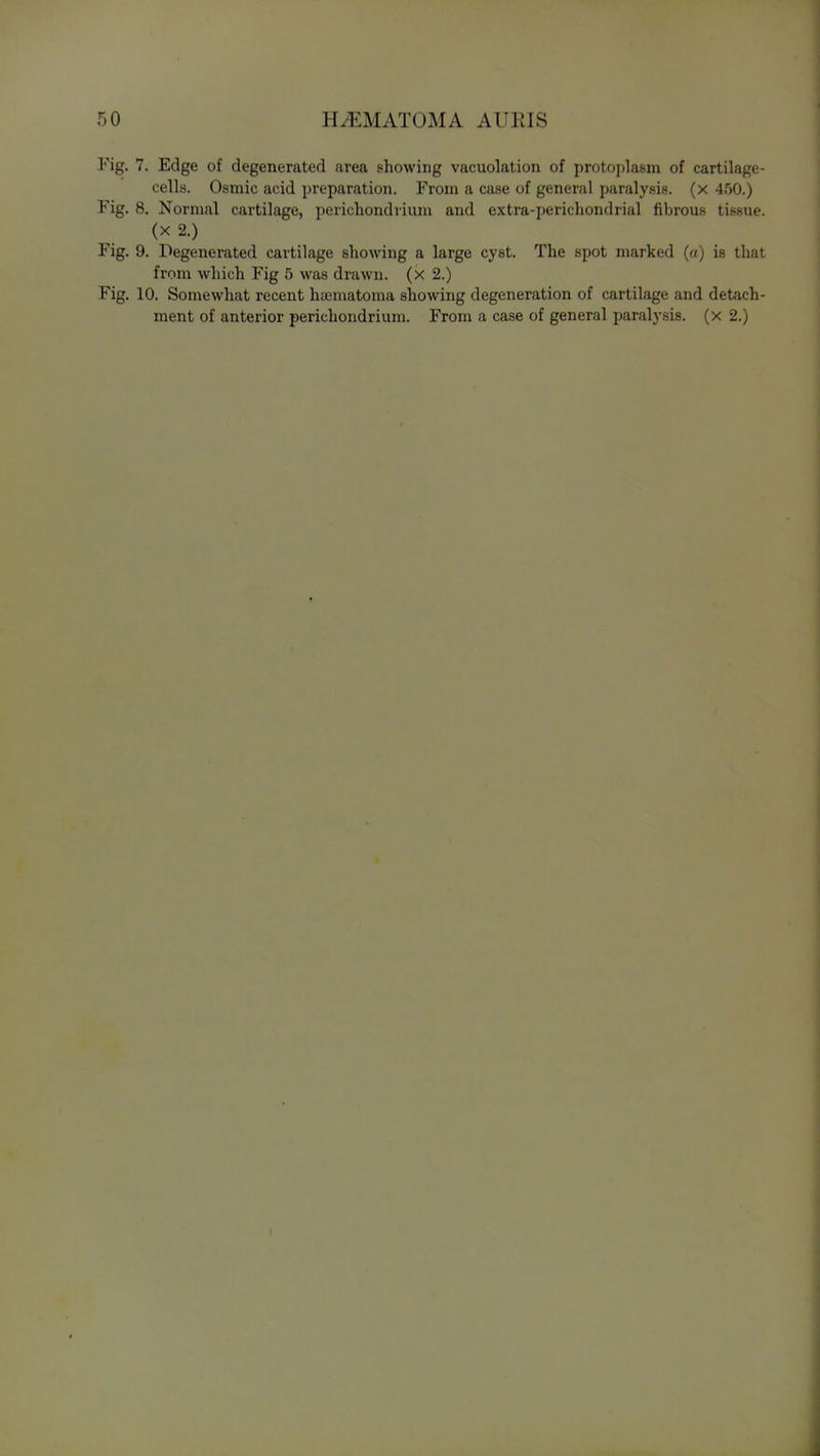 Fig. 7. Edge of degenerated area showing vacuolation of proto])lasm of cartilage- cells. Osmic acid preparation. From a case of general paralysis, (x 4.00.) Fig. 8. Normal cartilage, perichondrium and extra-perichondrial fibrous tissue. (X 2.) Fig. 9. Degenerated cartilage showing a large cyst. The spot marked (a) is that from which Fig 5 was drawn, (x 2.) Fig. 10. Somewhat recent hoematoma showing degeneration of cartilage and detach- ment of anterior perichondrium. From a case of general paralysis, (x 2.) I