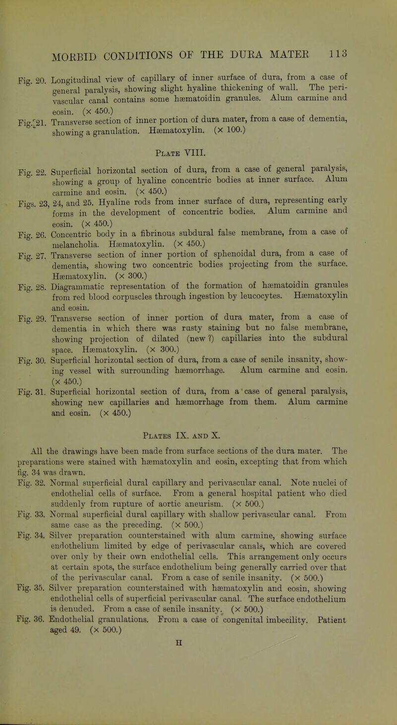 Fi^. 20. Longitudinal view of capillary of inner surface of dura, from a case of f^eneral paralysis, showing slight hyaline thickening of wall. The peri- vascular canal contains some hsematoidin granules. Alum carmine and eosin. (x 450.) Fig.^21. Transverse section of inner portion of dura mater, from a case of dementia, showing a granulation. Hsematoxylin. (X 100.) Plate VIII. Fic^. 22. Superficial horizontal section of dura, from a case of general paralysis, °' showing a group of hyaline concentric bodies at inner surface. Alum carmine and eosin. (x 450.) Figs. 23, 24, and 25. Hyaline rods from inner surface of dura, representing early ' forms in the development of concentric bodies. Alum carmine and eosin. (x 450.) Fig. 26. Concentric body in a fibrinous subdural false membrane, from a case of melancholia. Hsematoxylin. (x 450.) Fig. 27. Transverse section of inner portion of sphenoidal dura, from a case of dementia, showing two concentric bodies projecting from the surface. Hsematoxylin. (x 300.) Fig. 28. Diagrammatic representation of the formation of hsematoidin granules from red blood corpuscles through ingestion by leucocytes. Haematoxylin and eosin. Fig. 29. Transverse section of inner portion of dura mater, from a case of dementia in which there was rusty staining but no false membrane, showing projection of dilated (new 1) capillaries into the subdural space. Hsematoxylin. (x 300.) Fig. 30. Superficial horizontal section of dura, from a case of senile insanity, show- ing vessel with surrounding haemorrhage. Alum carmine and eosin. (X 450.) Fig. 31. Superficial horizontal section of dura, from a case of general paralysis, showing new capillaries and haemorrhage from them. Alum carmine and eosin. (x 450.) Plates IX. and X. All the drawings have been made from surface sections of the dura mater. The preparations were stained with haematoxylin and eosin, excepting that from which fig. 34 was drawn. Fig. 32. Normal superficial dural capillary and perivascular canal. Note nuclei of endothelial cells of surface. From a general hospital patient who died suddenly from rupture of aortic aneurism, (x 500.) Fig. 33. Normal superficial dural capillary with shallow perivascular canal. From same case as the preceding, (x 500.) Fig. 34 Silver preparation counterstained with alum carmine, showing surface endothelium limited by edge of perivascular canals, which are covered over only by their own endothelial cells. This arrangement only occurs at certain spots, the surface endothelium being generally carried over that of the perivascular canal. From a case of senile insanity, (x 500.) Fig. 35. Silver preparation counterstained with haematoxylin and eosin, showing endothelial cells of superficial perivascular canal. The surface endothelium is denuded. From a case of senile insanity, (x 500.) Fig. 36. Endothelial granulations. From a case of congenital imbecility. Patient aged 49. (x 500.) H