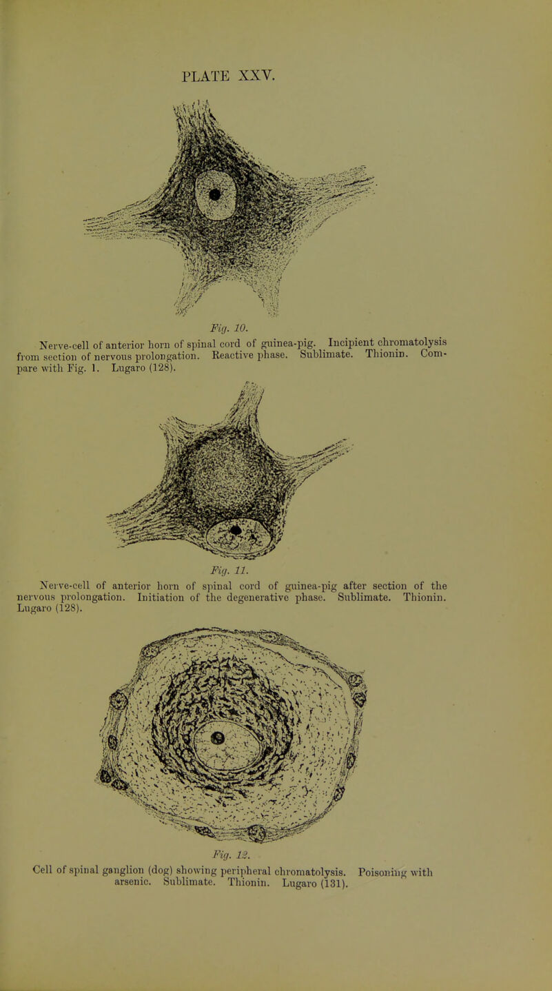 Fig. 10. Nerve-cell of anterior horn of spinal cord of guinea-pig. Incipient chromatolysis from section of nervous prolongation. Reactive phase. Sublimate. Thionin. Com- pare with Fig. 1. Lugaro (128). Fig. 11. Nerve-cell of anterior horn of spinal cord of guinea-pig after section of the nervous prolongation. Initiation of the degenerative phase. Sublimate. Thionin. Lugaro (128). Fig. 12. Cell of spinal ganglion (dog) showing peripheral chromatolysis. Poisoning with arsenic. Sublimate. Thionin. Lugaro (131).