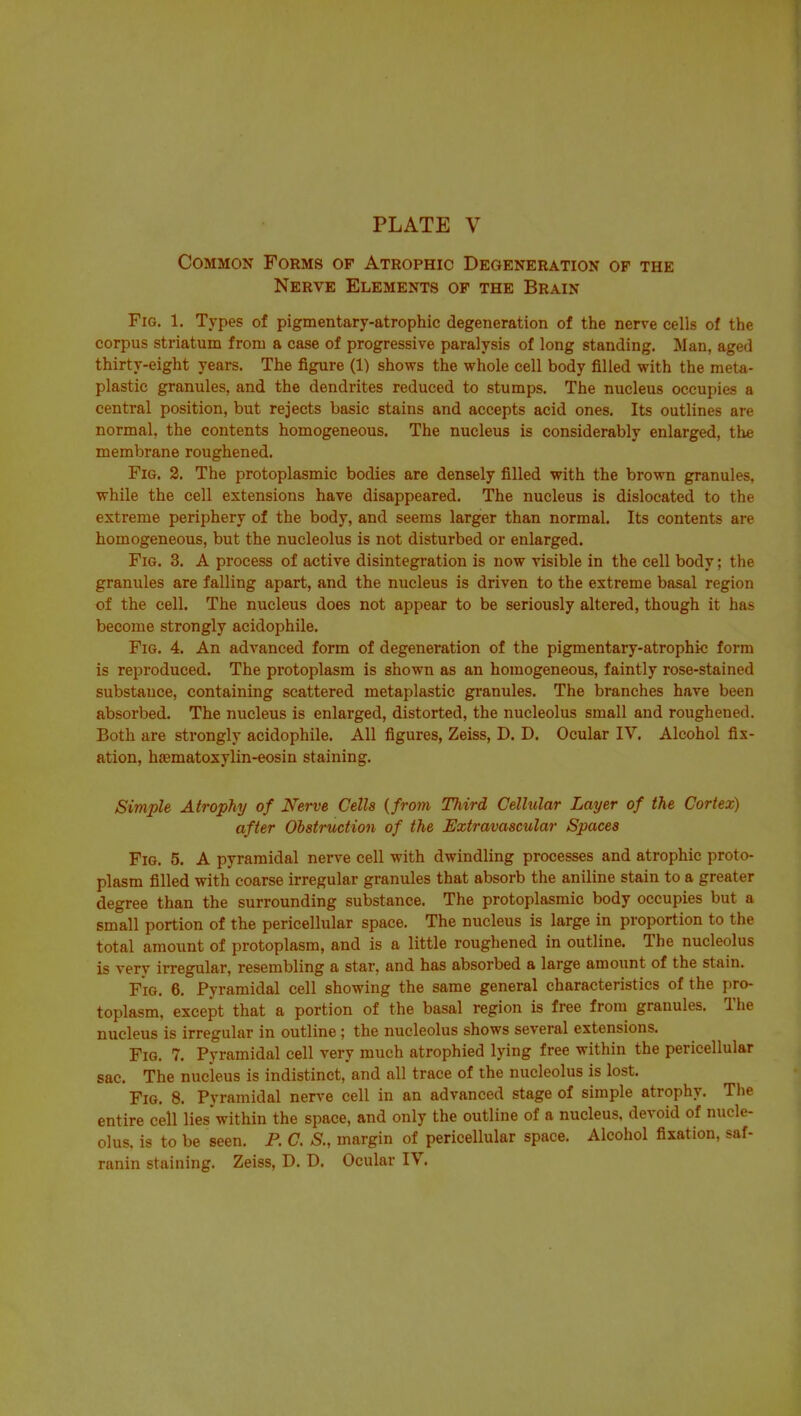 Common Forms of Atrophic Degeneration op the Nerve Elements of the Brain Fig. 1. Types of pigmentary-atrophic degeneration of the nerve cells of the corpus striatum from a case of progressive paralysis of long standing. Man, aged thirty-eight years. The figure (1) shoves the whole cell body filled with the meta- plastic granules, and the dendrites reduced to stumps. The nucleus occupies a central position, but rejects basic stains and accepts acid ones. Its outlines are normal, the contents homogeneous. The nucleus is considerably enlarged, tlie membrane roughened. Fig. 2. The protoplasmic bodies are densely filled with the brown granules, while the cell extensions have disappeared. The nucleus is dislocated to the extreme periphery of the body, and seems larger than normal. Its contents are homogeneous, but the nucleolus is not disturbed or enlarged. Fig. 3. A process of active disintegration is now visible in the cell body; the granules are falling apart, and the nucleus is driven to the extreme basal region of the cell. The nucleus does not appear to be seriously altered, though it has become strongly acidophile. Fig. 4. An advanced form of degeneration of the pigmentary-atrophic form is reproduced. The protoplasm is shown as an homogeneous, faintly rose-stained substance, containing scattered metaplastic granules. The branches have been absorbed. The nucleus is enlarged, distorted, the nucleolus small and roughened. Both are strongly acidophile. All figures, Zeiss, D. D. Ocular IV. Alcohol fix- ation, haematoxylin-eosin staining. Simple Atrophy of Nerve Cells {from Third Cellular Layer of the Cortex) after Obstruction of the Extravascular Spaces Fig. 5. A pyramidal nerve cell with dwindling processes and atrophic proto- plasm filled with coarse irregular granules that absorb the aniline stain to a greater degree than the surrounding substance. The protoplasmic body occupies but a small portion of the pericellular space. The nucleus is large in proportion to the total amount of protoplasm, and is a little roughened in outline. The nucleolus is very irregular, resembling a star, and has absorbed a large amount of the stain. Fig. 6. Pyramidal cell showing the same general characteristics of the pro- toplasm, except that a portion of the basal region is free from granules. The nucleus is irregular in outline ; the nucleolus shows several extensions. Fig. 7. Pyramidal cell very much atrophied lying free within the pericellular sac. The nucleus is indistinct, and all trace of the nucleolus is lost. Fig. 8. Pyramidal nerve cell in an advanced stage of simple atrophy. The entire cell lies'within the space, and only the outline of a nucleus, devoid of nucle- olus, is to be seen. P. C. S., margin of pericellular space. Alcohol fixation, saf- ranin staining. Zeiss, D. D. Ocular IV.