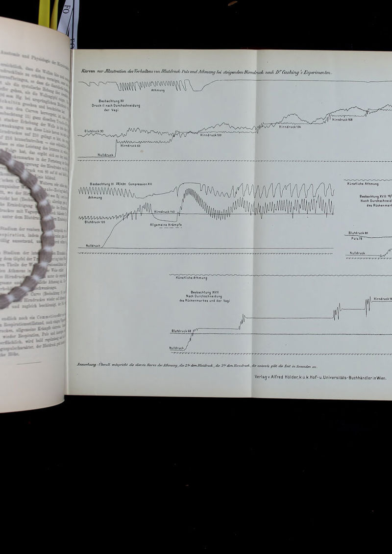 Beobachtung XV Druck Ii nach Durchschneidung der Vagi Beobachlung III 28/iii/oi CompressionXIII Aihmung Bluidruch 120 Künstliche Athmunq Beobachtung XVIII Nach Ourchschneidung des Rückenmarkes und der Vagi' Künstliche Athmung Beobechfung XVIII 19/\ Nach Durchschneid des Rückenmart Nulldruck J ^ J Ammrimng.- IHiemU, eiLU/imiil die obersle. Kiii-ve Ja Aammiu/, dieZIf dimJ/luldiiiA, die :i<r dem /tümirijds.,die unlersU ,fiM die Zdl. iii. Senmdai ait. Verlag V.Alfred Holder, k.u.k.Hof-u.Univepsitäts-Buchhändler in Wien.