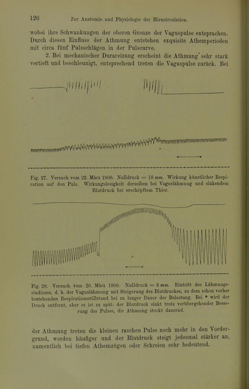 wobei ihre Schwankungen der oberen Grenze der Vaguspulse entsprachen. Durch diesen Einfluss der Athmung entstehen exquisite Athemperioden mit circa fünf Pulsschlägen in der Pulscurve. 2. Bei mechanischer Durareizung erscheint die Athmung* sehr stark vertieft und beschleunigt, entsprechend treten die Vaguspulse zurück. Bei mii . Fig. 27. Versuch vom 22. März 1900. Nulldruck = 18 mm. Wirkung künstlicher Kespi- i-ation auf den Puls. Wirkungslosigkeit derselben bei Vaguslähmung und sinkendem Blutdruck bei erschöpftem Thier. t > > \ III! >—+• Fig. 28. Versuch vom 20. März 1900. Nulldruck = 8 mm. Eintritt des Lähmungs- stadiums, d. h. der Vaguslähmung mit Steigerung des Blutdruckes, zu dem schon vorher bestehenden Eespirationsstillstand bei zu langer Dauer der Belastung. Bei * wird der Druck entfernt, aber es ist zu spät: der Blutdruck sinkt trotz vorübergehender Besse- rung des Pulses, die Athmung stockt dauernd. der Athmung treten die kleinen raschen Pulse noch mehr in den Vorder- grund, werden häufiger und der Blutdruck steigt jedesmal stärker an, namentlich bei tiefen Athemzügen oder Schreien sehr bedeutend.