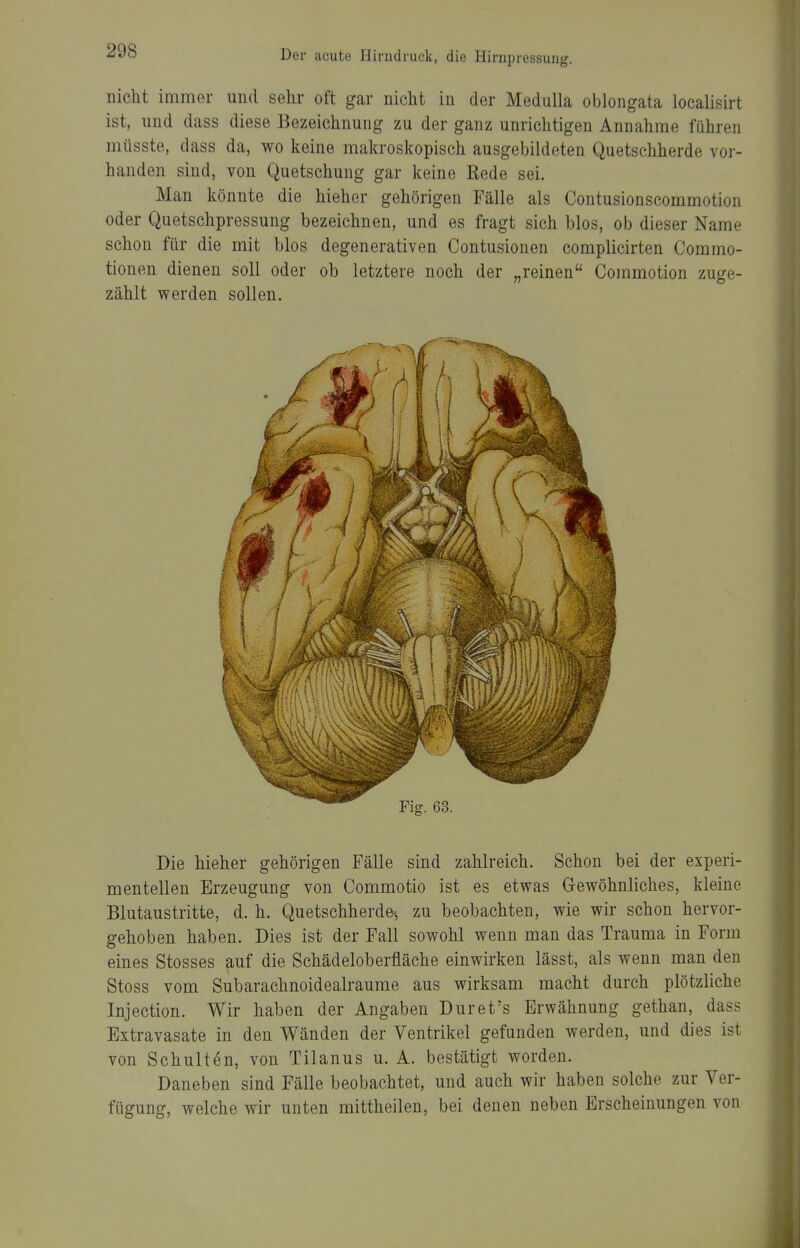 nicht immer und sehr oft gar nicht in der Medulla oblongata localisirt ist, und dass diese Bezeichnung zu der ganz unrichtigen Annahme führen müsste, dass da, wo keine makroskopisch ausgebildeten Quetschherde vor- handen sind, von Quetschung gar keine Rede sei. Man könnte die hieher gehörigen Fälle als Contusionscommotion oder Quetschpressung bezeichnen, und es fragt sich blos, ob dieser Name schon für die mit blos degenerativen Contusionen complicirten Commo- tionen dienen soll oder ob letztere noch der „reinen Commotion zuge- zählt werden sollen. Die hieher gehörigen Fälle sind zahlreich. Schon bei der experi- mentellen Erzeugung von Commotio ist es etwas Gewöhnliches, kleine Blutaustritte, d. h. Quetschherde-, zu beobachten, wie wir schon hervor- gehoben haben. Dies ist der Fall sowohl wenn man das Trauma in Form eines Stosses auf die Schädeloberfläche einwirken lässt, als wenn man den Stoss vom Subarachnoidealraume aus wirksam macht durch plötzliche Injection. Wir haben der Angaben Duret's Erwähnung gethan, dass Extravasate in den Wänden der Ventrikel gefunden werden, und dies ist von Schultön, von Tilanus u. A. bestätigt worden. Daneben sind Fälle beobachtet, und auch wir haben solche zur Ver- fügung, welche wir unten mittheilen, bei denen neben Erscheinungen von