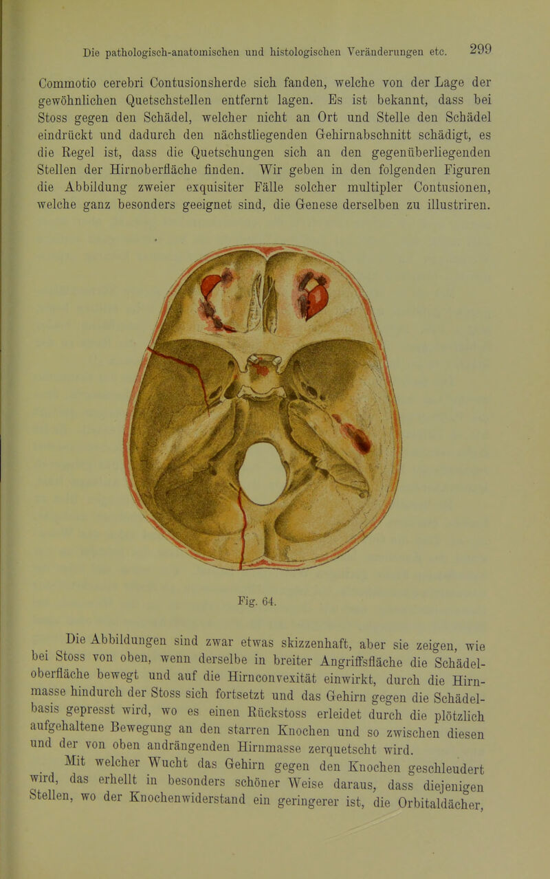 Commotio cerebri Contusionsherde sich fanden, welche von der Lage der gewöhnlichen Quetschstellen entfernt lagen. Es ist bekannt, dass bei Stoss gegen den Schädel, welcher nicht an Ort und Stelle den Schädel eindrückt und dadurch den nächstliegenden Gehirnabschnitt schädigt, es die Regel ist, dass die Quetschungen sich an den gegenüberliegenden Stellen der Hirnoberfläche finden. Wir geben in den folgenden Figuren die Abbildung zweier exquisiter Fälle solcher multipler Contusionen, welche ganz besonders geeignet sind, die Genese derselben zu illustriren. Fig. 64. Die Abbildungen sind zwar etwas skizzenhaft, aber sie zeigen, wie bei Stoss von oben, wenn derselbe in breiter Angriffsfläche die Schädel- oberfläche bewegt und auf die Hirnconvexität einwirkt, durch die Hirn- masse hindurch der Stoss sich fortsetzt und das Gehirn gegen die Schädel- basis gepresst wird, wo es einen Rückstoss erleidet durch die plötzlich aufgehaltene Bewegung an den starren Knochen und so zwischen diesen und der von oben andrängenden Hirnmasse zerquetscht wird. Mit welcher Wucht das Gehirn gegen den Knochen geschleudert wird, das erhellt in besonders schöner Weise daraus, dass diejenic^en Stellen, wo der Knochenwiderstand ein geringerer ist, die Orbitaldächer